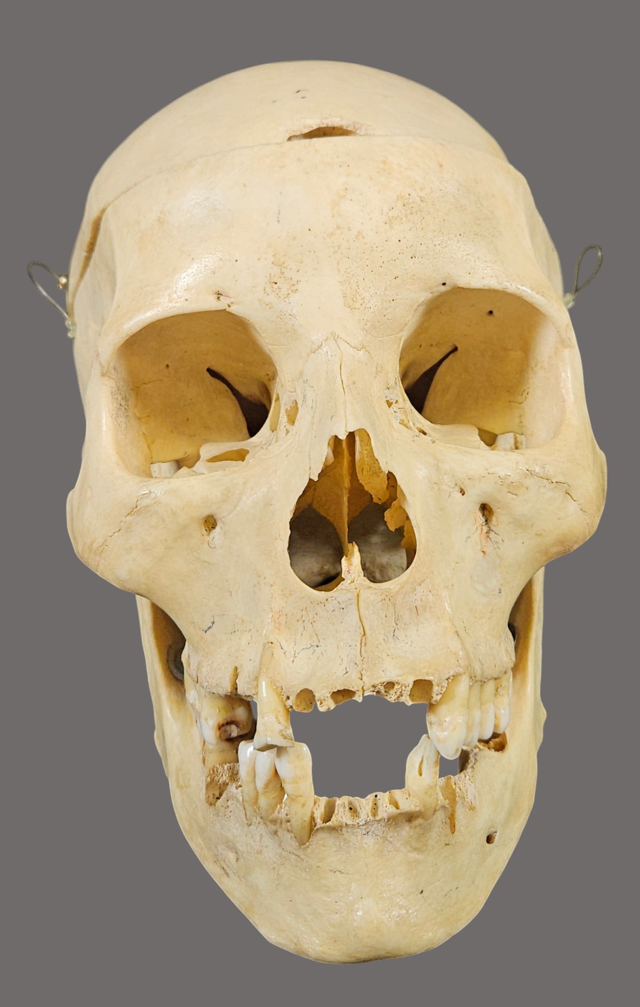 Vintage Medical Skull in Original Box: Missing some teeth, please see photos.