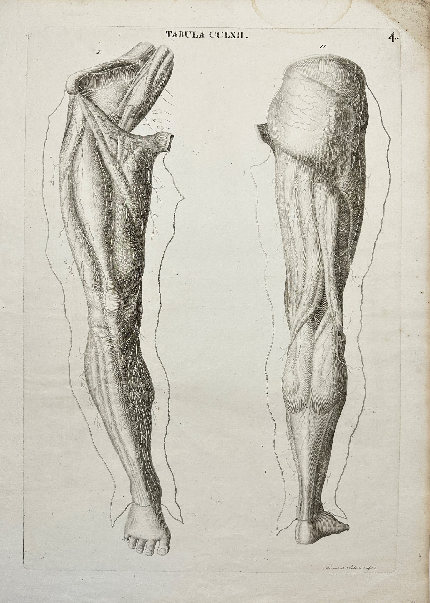 Antonio Caldani - Anatomy Antique Print - Calf Muscles of the Legs: ”TABULA CCLXII.” This superb anatomy engraving is from Leopoldo Marco Antonio Caldani’s ”Icones anatomicae; Iconum anatomicarum explicatio.” The work was published in Venice,