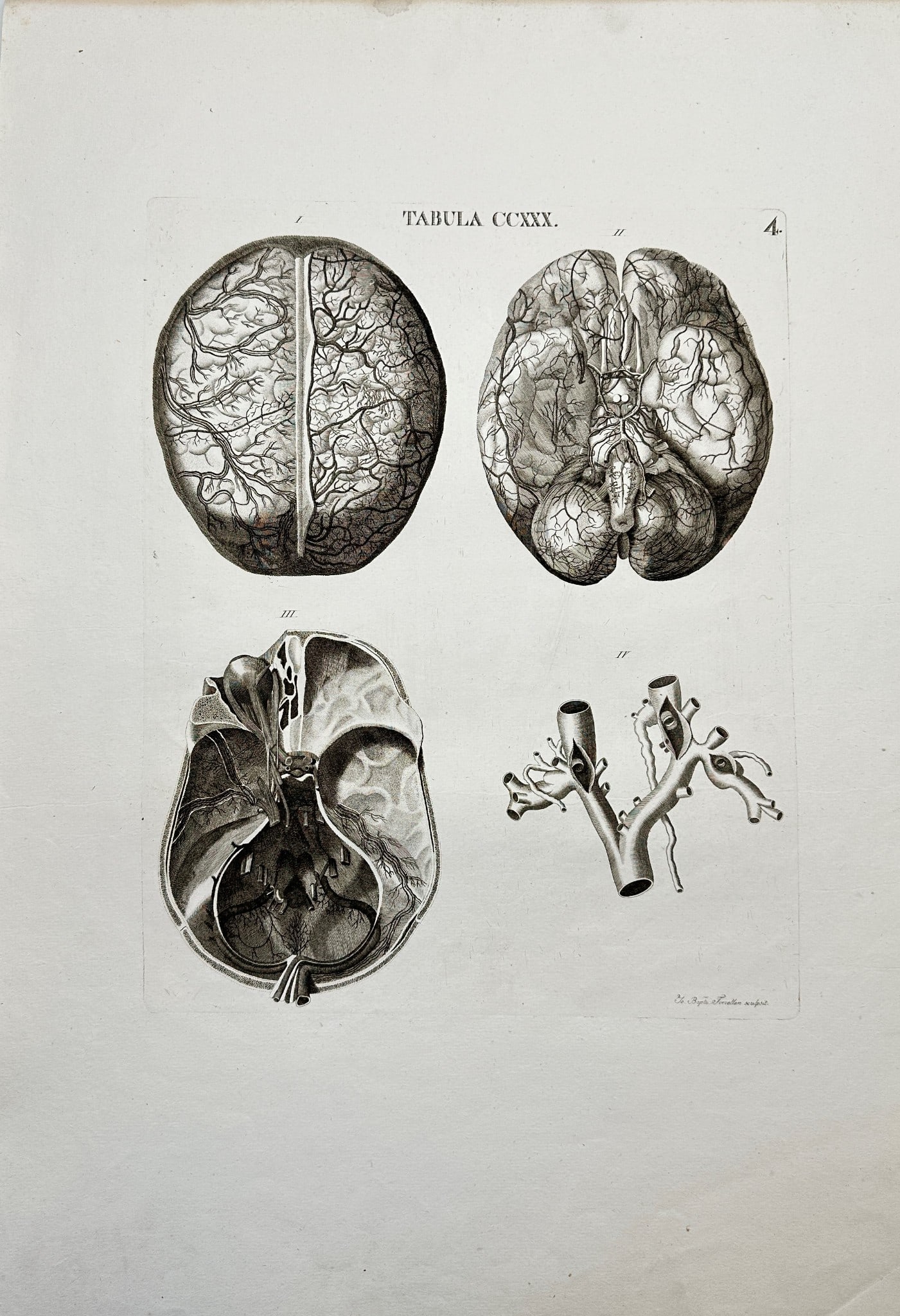 Antonio Caldani - Anatomy Antique Print - Cranial Nerves, Brain, Membranes: ”TABULA CCXXX” This superb anatomy engraving is from Leopoldo Marco Antonio Caldani’s ”Icones anatomicae; Iconum anatomicarum explicatio.” The work was published in Venice, 1