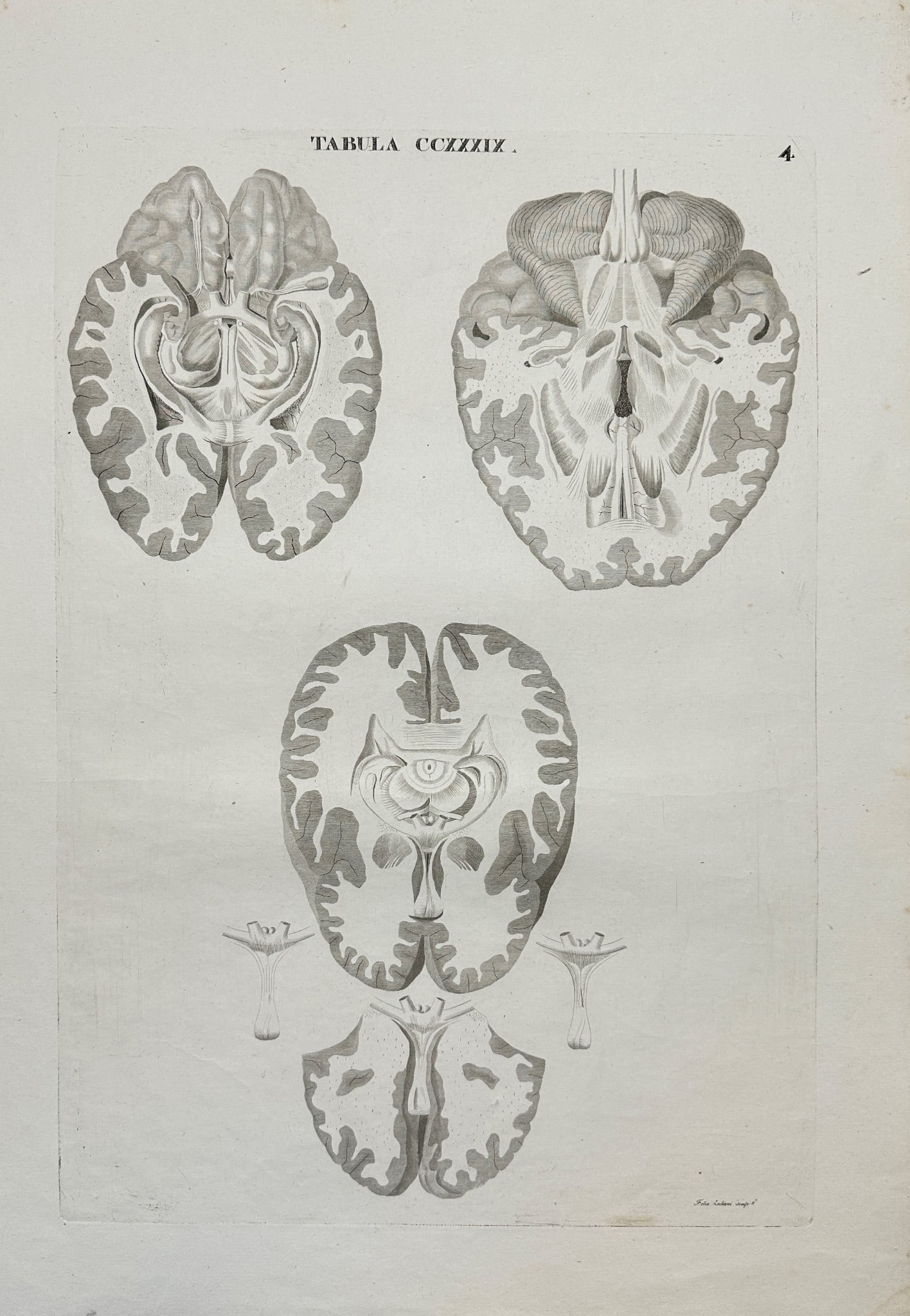Antonio Caldani - Anatomy Antique Print - View From Inside the Skull: TABULA COZZZIX – This superb anatomical engraving is from Leopoldo Marco Antonio Caldani’s Icones Anatomicae; Iconum Anatomicarum Explicatio, published in Venice between 1801 and 1814. Icones Anat