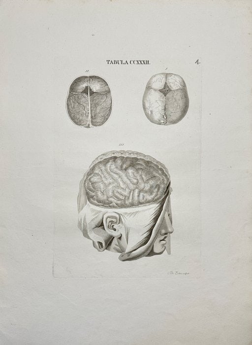 Antonio Caldani – Anatomical Engraving – Human Brain – Tabula COXXXIL – Engraving (1 of 5)