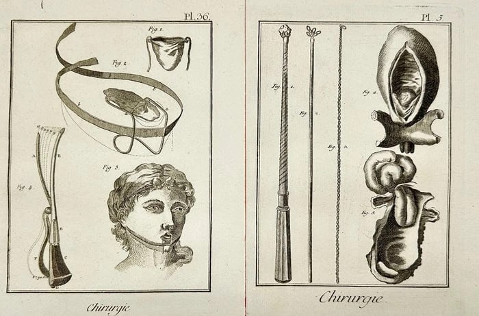 Denis Diderot (1713–1784) – Set of 2 Copperplate Engravings of Surgical Instruments & Anatomy: This set of two original copperplate engravings, created under the direction of Denis Diderot for the Encyclopédie, presents an intricate depiction of surgical tools and anatomical diagrams. The left
