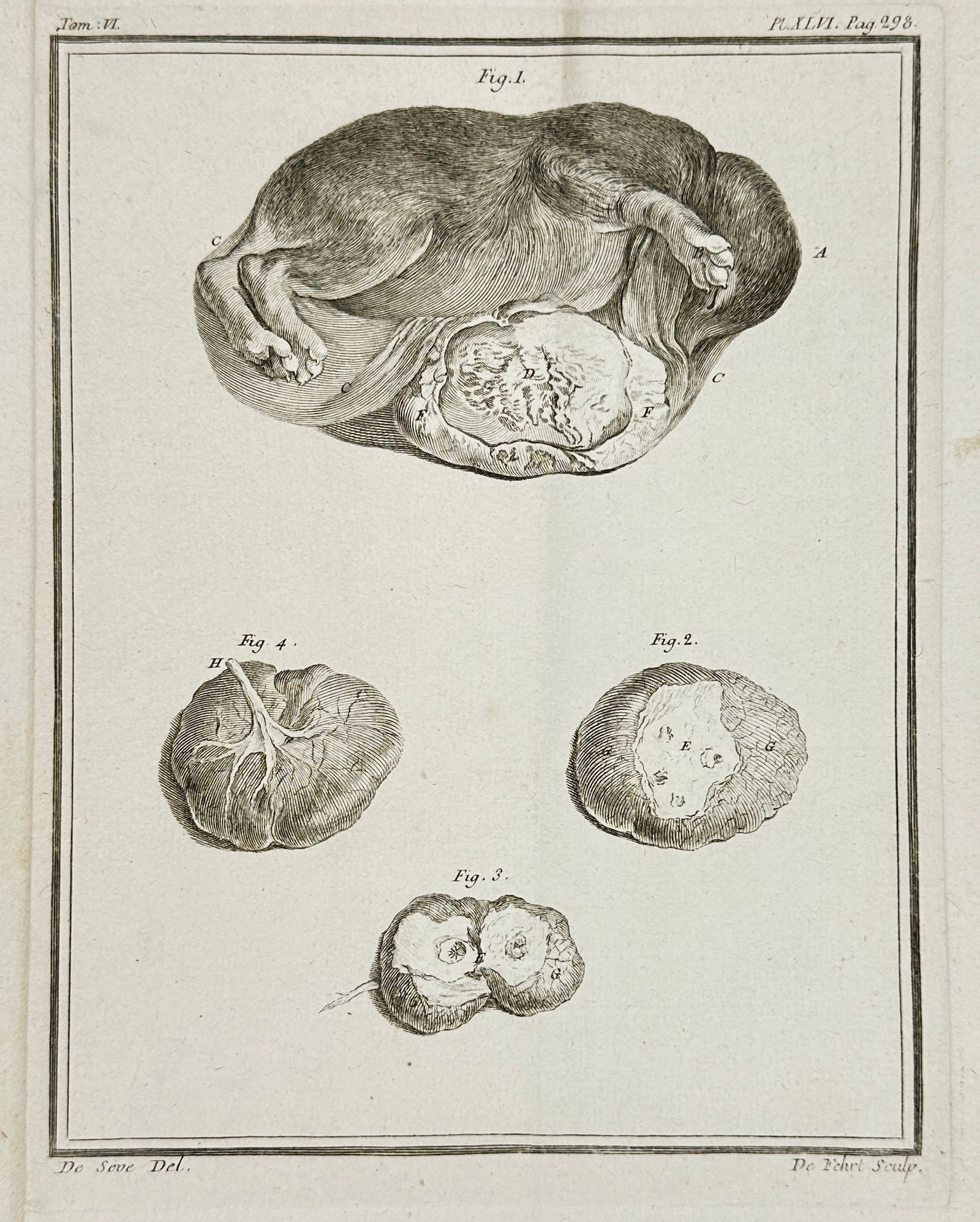 Jacques de Sève – Comparative Fetal and Organ Studies – Copperplate Engraving – 18th Century: This anatomical engraving by Jacques de Sève presents a detailed comparative study of fetal development and internal organs, likely prepared for the Histoire Naturelle series or a contemporary Enligh
