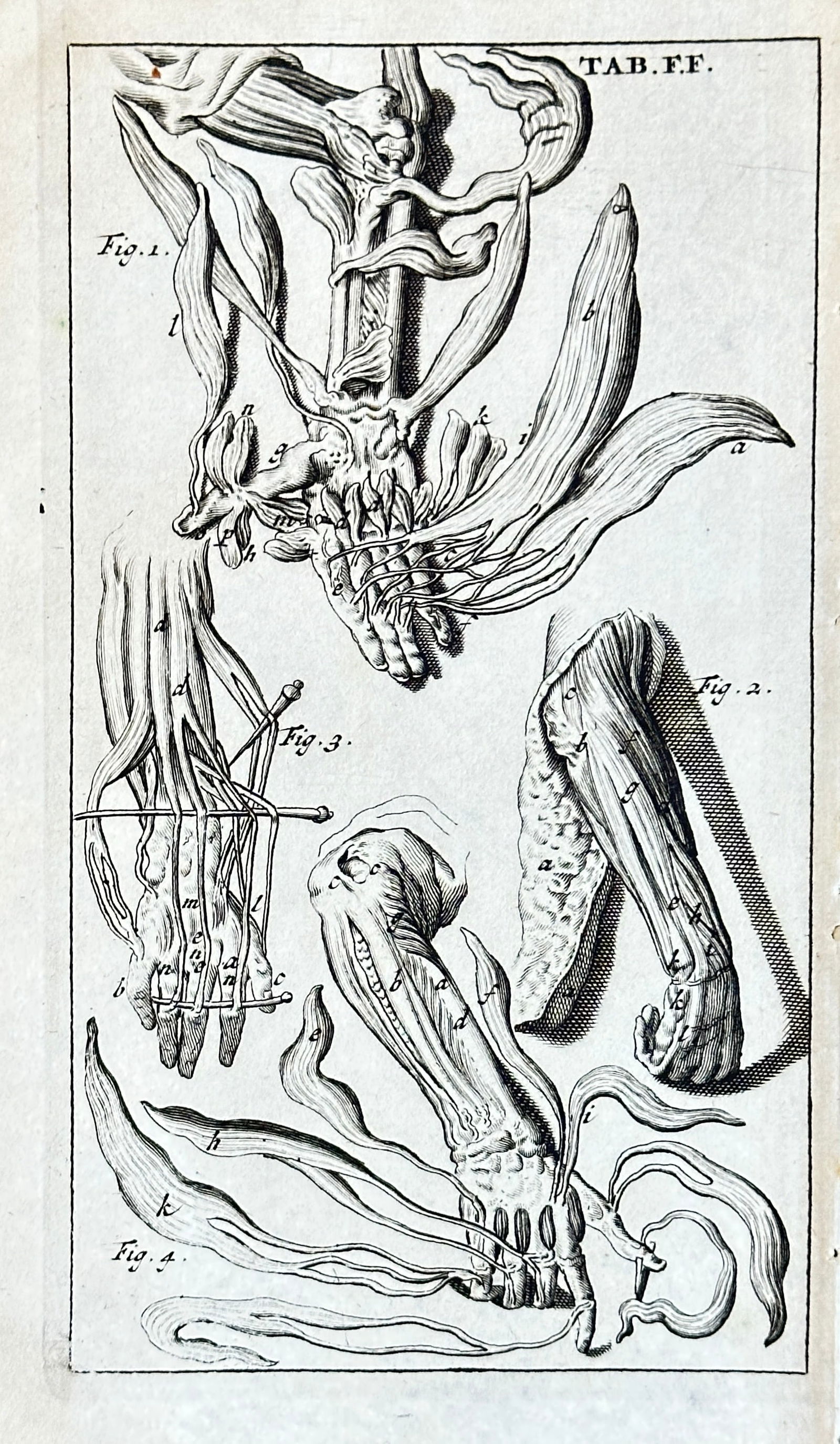 Steven Blankaart – Anatomy of Muscles and Limbs from "Anatomia reformata" – Engraving (1 of 3)