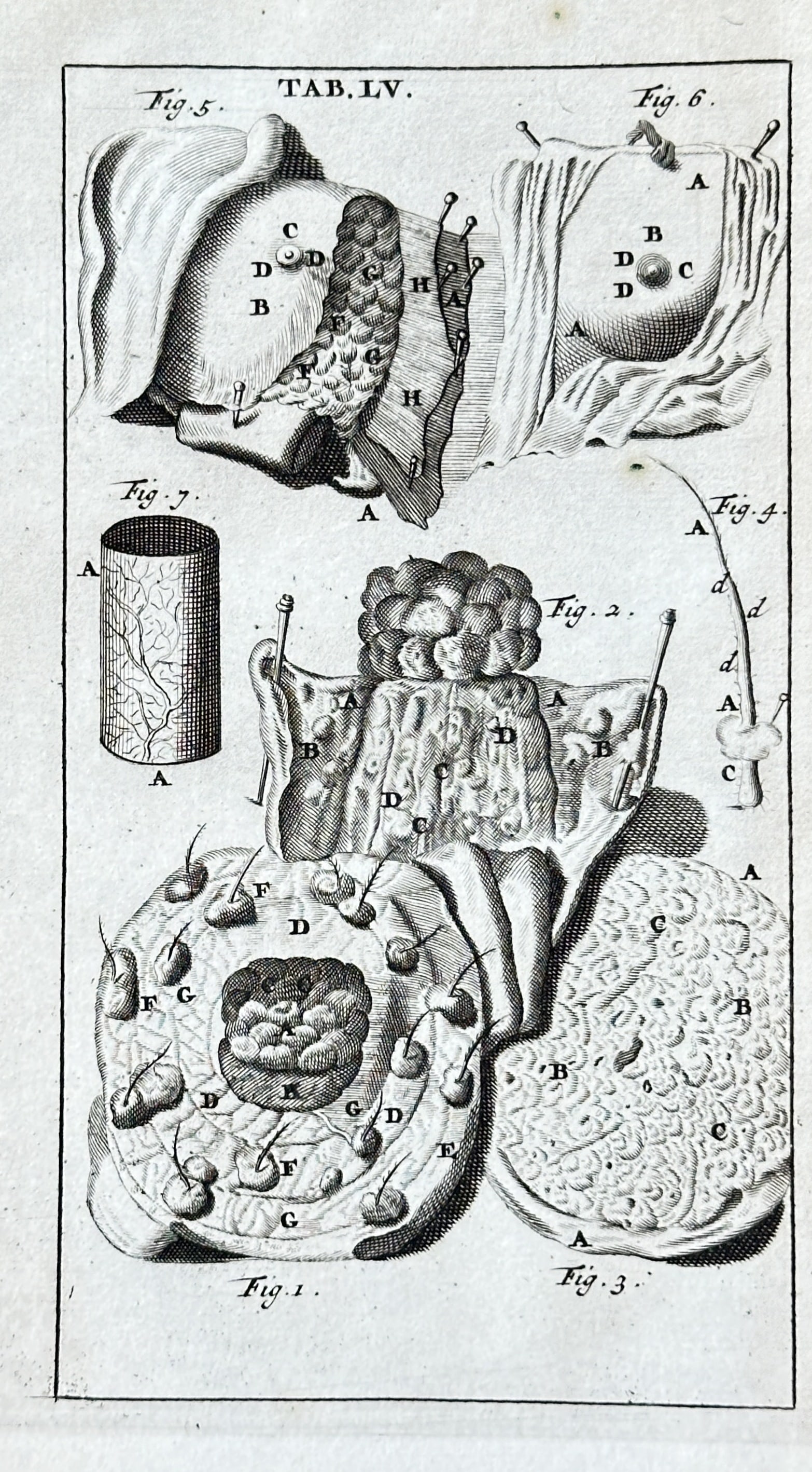 Steven Blankaart (1650–1702) – Anatomical Study, Plate LV – Engraving (circa 1686): This engraving, labeled "TAB.LV," presents a detailed anatomical study focusing on complex biological structures, related to glands or secretory organs. The print features multiple numbered figures, m