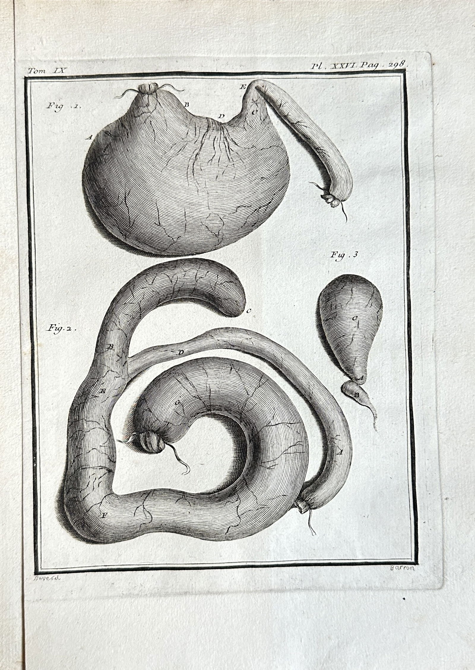 Georges-Louis Leclerc, Comte de Buffon – Anatomical Study of Internal Organs or Parasites: This original 18th-century engraving presents a detailed anatomical study featuring three distinct figures of internal organs or large parasitic worms. Figure 1 depicts a large, rounded, sac-like stru
