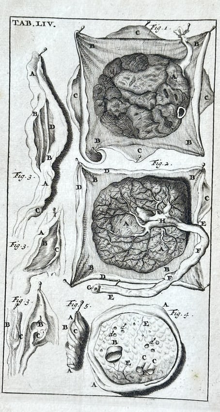 Steven Blankaart (1650–1702) – Anatomical Study, Plate LIV – Engraving: This engraving, labeled "TAB.LIV," presents a detailed anatomical study focusing on internal organs or complex tissue structures. The print features multiple figures, meticulously illustrating various