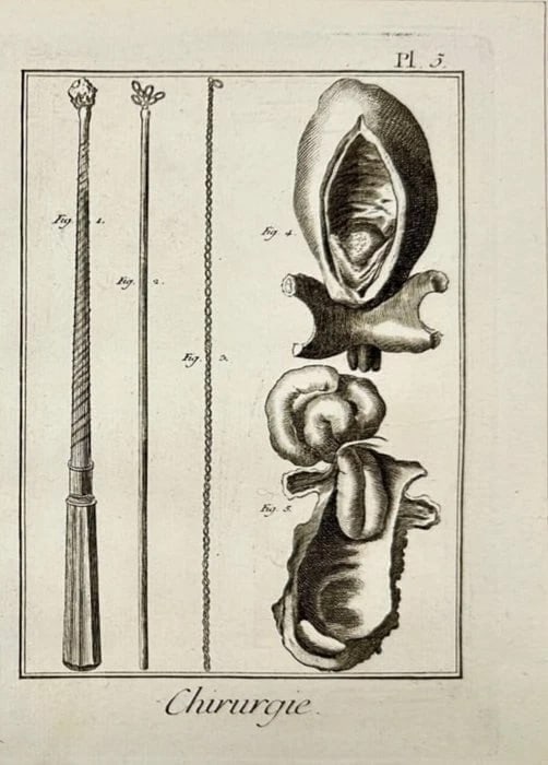 Denis Diderot – Copperplate Engraving of Surgical Instruments Plate 1: This original copperplate engraving is from the Chirurgie (Surgery) section of Denis Diderot’s Encyclopédie, a cornerstone of Enlightenment knowledge. This meticulously labeled diagram reflect the