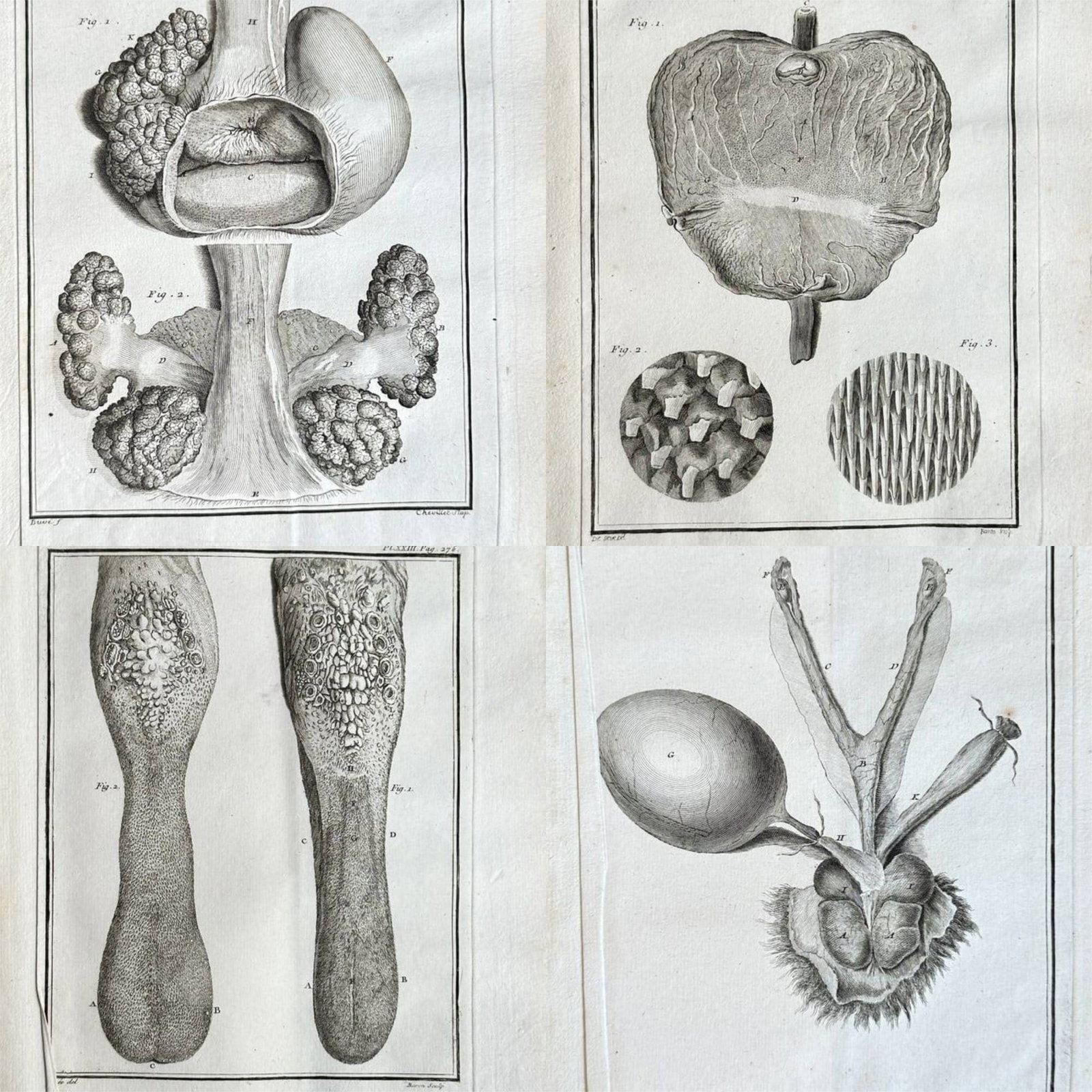 Georges-Louis Leclerc, Comte de Buffon– Set of Four: Detailed Anatomical Studies of Organs: This set comprises two detailed anatomical engravings illustrating invertebrates, specifically Gastropods (snails and slugs) and Crustaceans (crabs and lobsters). The plates display complex dissection