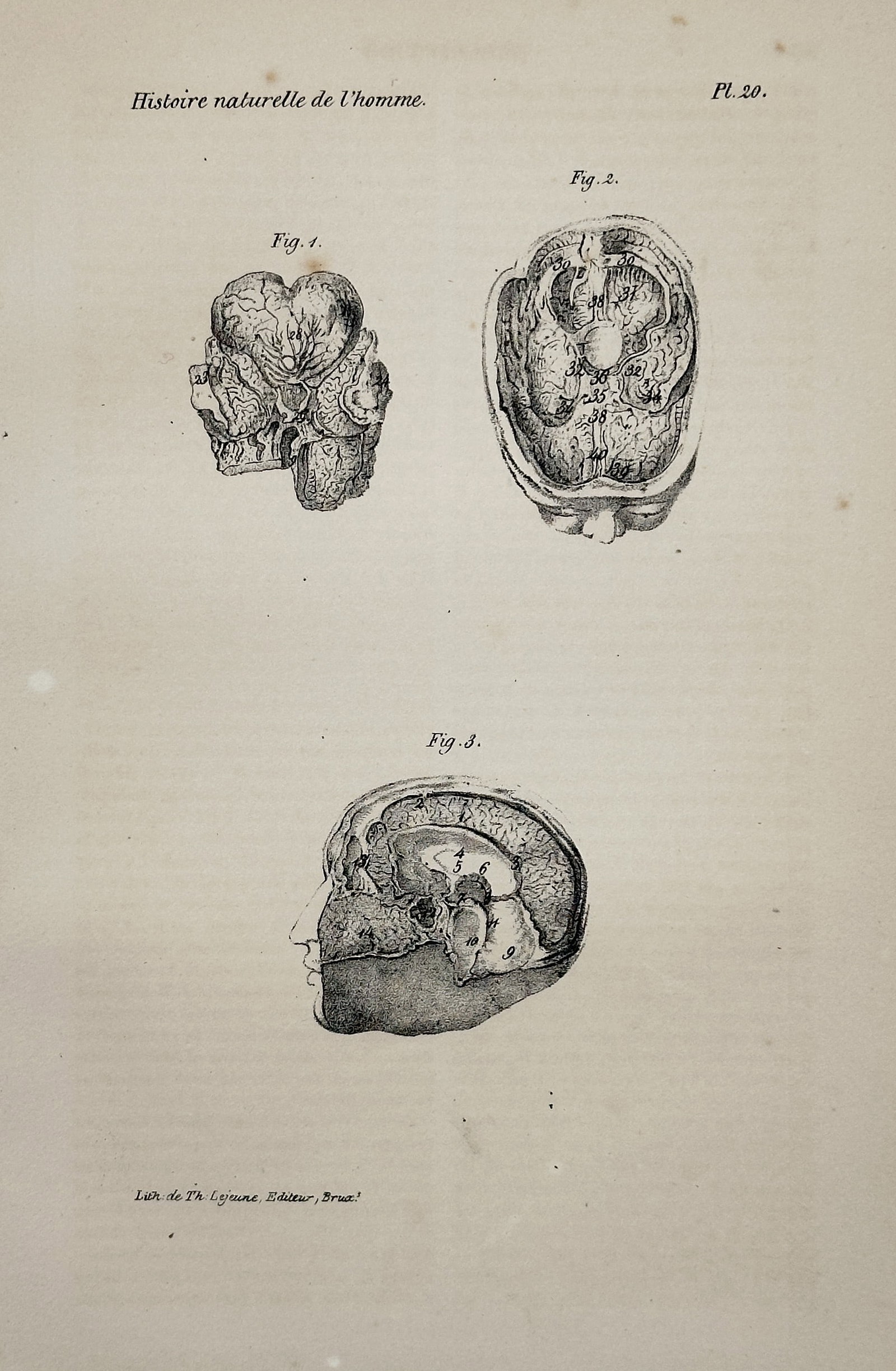 Georges Louis Leclerc Buffon –Anatomy of the Brain (Hist. nat. de l'homme) – Lithograph (c.: This lithograph presents three anatomical views of the human brain, including cross-sections. It is plate 20 from the "Histoire naturelle de l'homme" (Natural History of Man), part of the "Oeuvres com