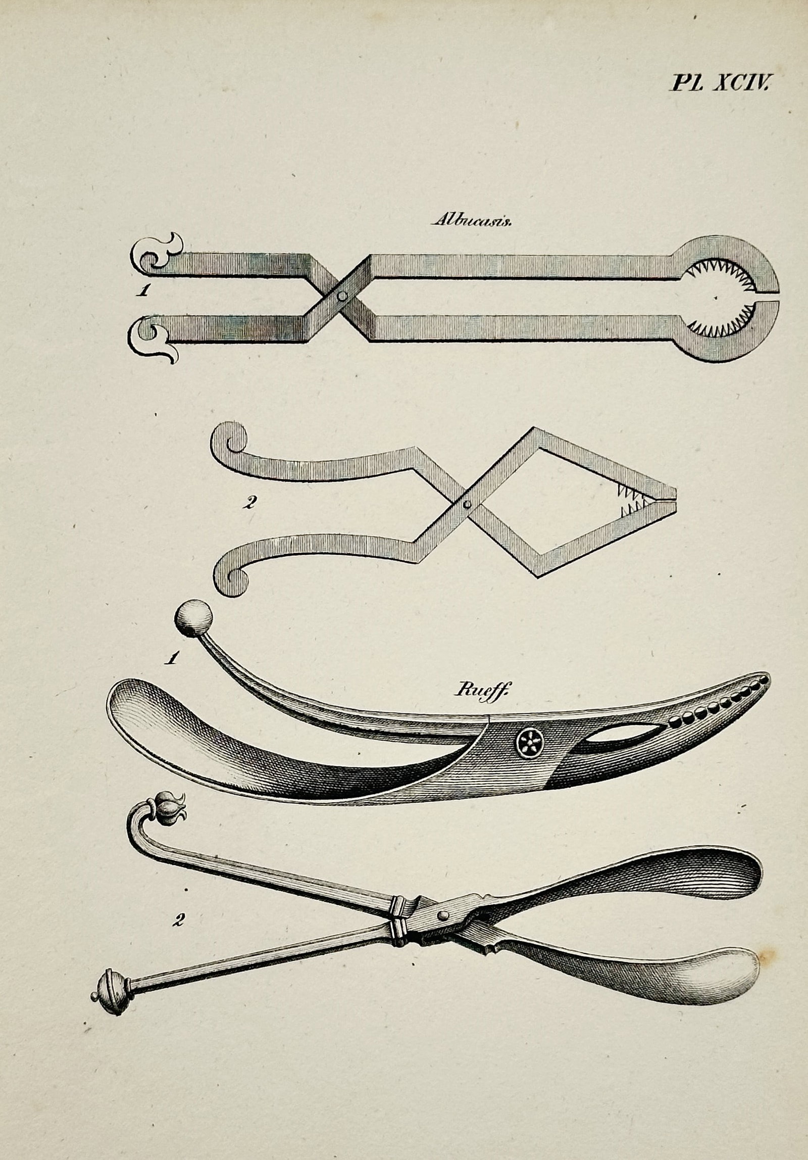 Denis Diderot (1713–1784) – Anatomical Study of a Pregnant Abdomen (Plate XCIV) – Engraving: This print is a detailed anatomical illustration (Plate XCIV) The engraving highlights the external changes and potential skin tension, with lines drawn on the abdomen to suggest possible measurement
