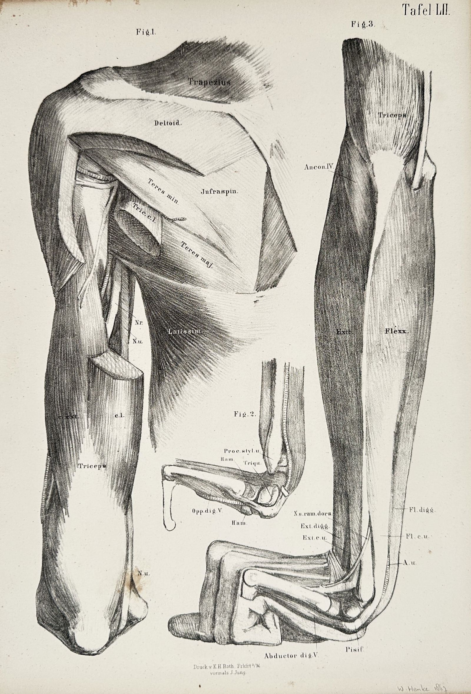 J. Jung – Anatomical Illustration of the Muscles of the Arm and Forearm – Engraving (19th (1 of 2)