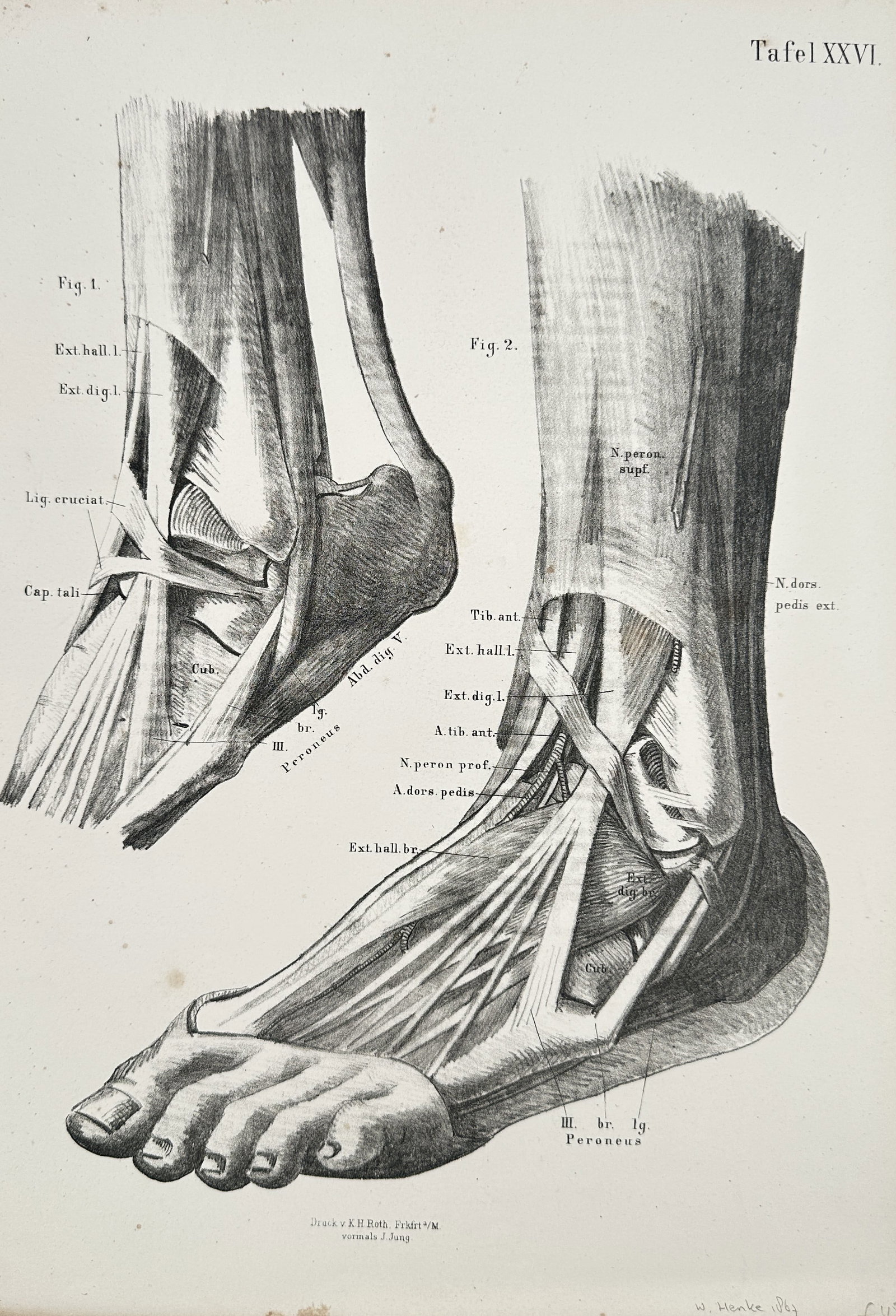 J. Jung (Active 1830–1860) – Ankle and Foot Anatomy – Lithograph (circa 1850) (1 of 2)