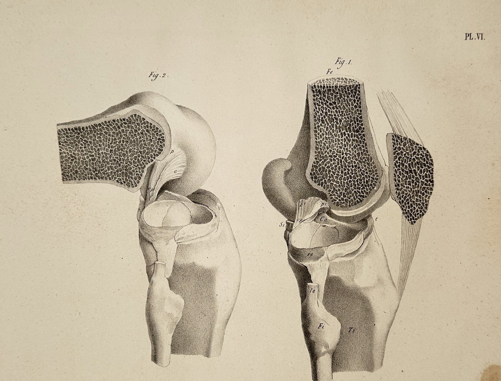Carl Heitzmann (1836–1896) – Anatomical Study of the Knee Joint, Plate VI – Lithograph: This lithograph is a scientific illustration detailing the anatomy of the human knee joint, published as Plate VI of an anatomical or morphological atlas. Carl Heitzmann was an Austrian-American patho