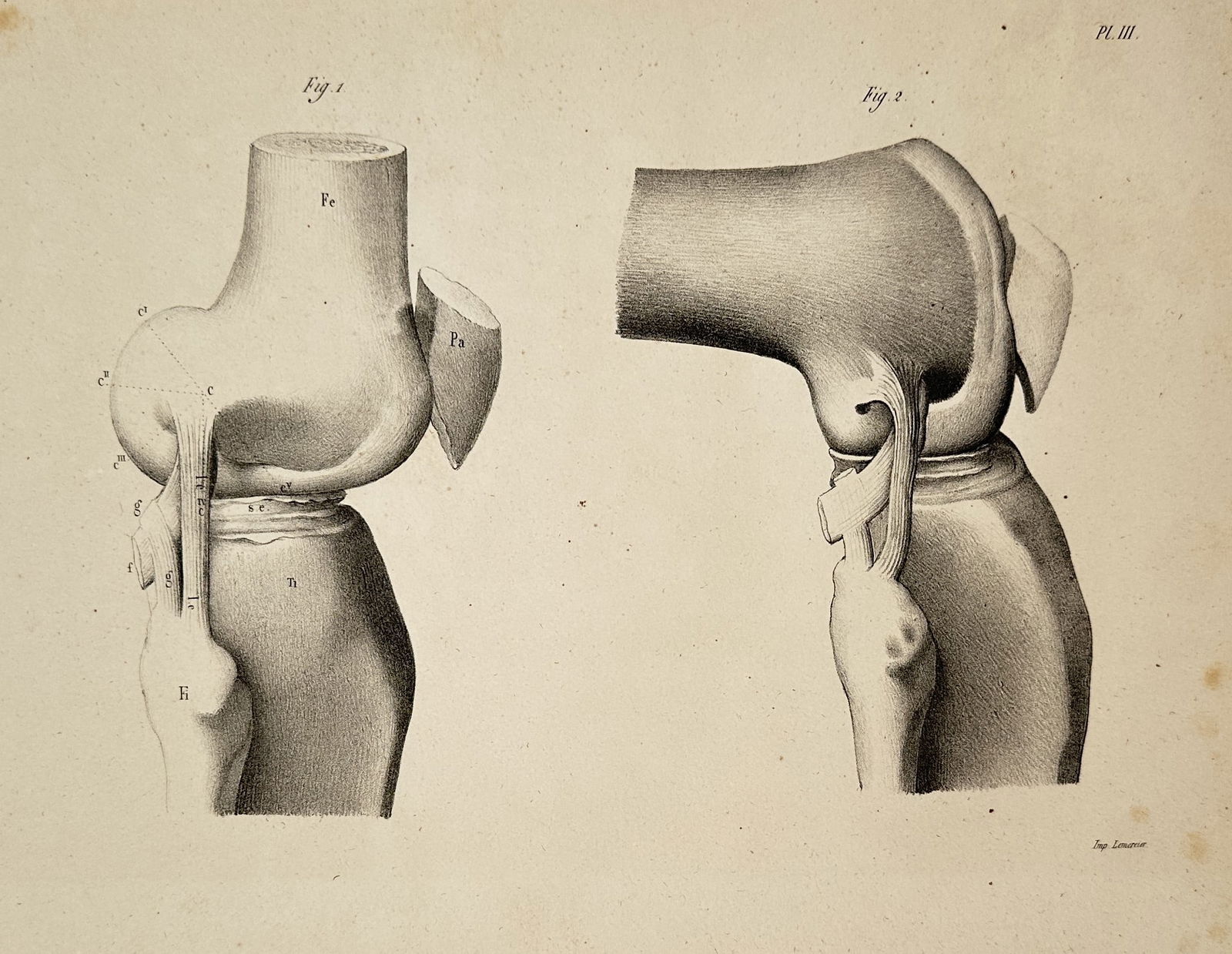 Carl Heitzmann (1836–1896) – Anatomical Study of the Knee Joint, Plate VIII – Lithograph (1 of 2)