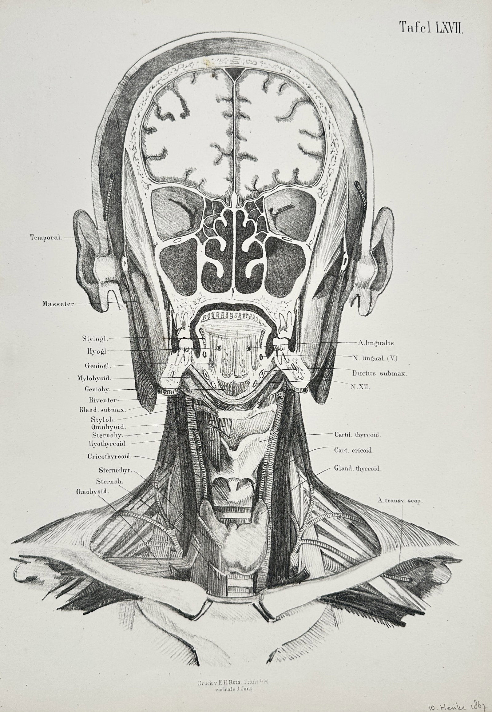 J. Jung (Active 1830–1860) – Deep Head and Neck Anatomy – Lithograph (circa 1850) (1 of 2)