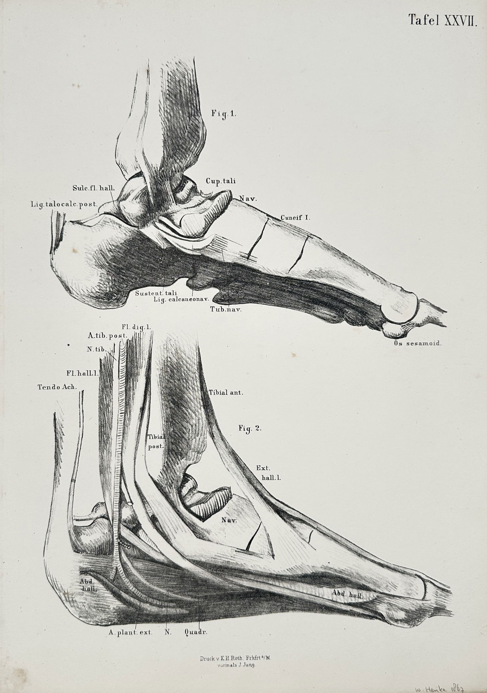 J. Jung (Active 1830–1860) – Foot Bones, Joints, and Tendons – Lithograph (circa 1850) (1 of 2)