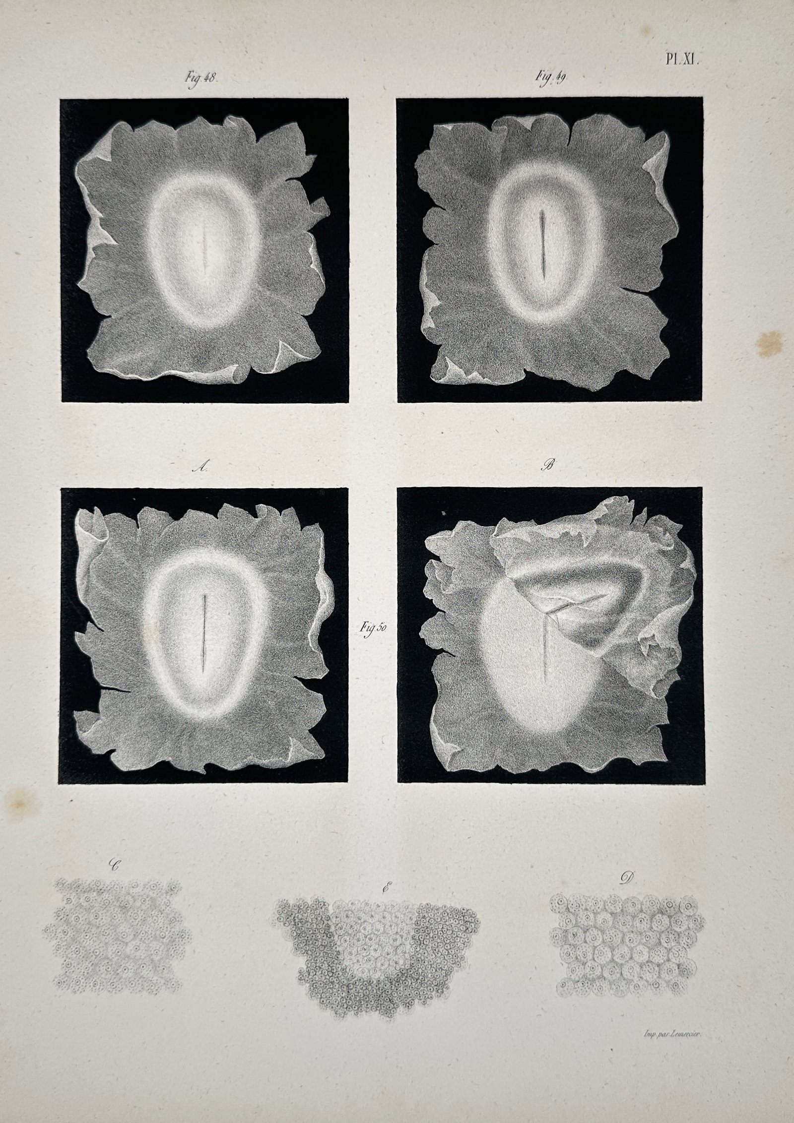 Jean-Baptiste Marc Bourgery – Formation of the Primitive Streak in the Embryonic Disk: This engraving illustrates several stages in early embryology, focusing on the appearance and elongation of the primitive streak within the blastoderm, which marks the beginning of gastrulation. The f
