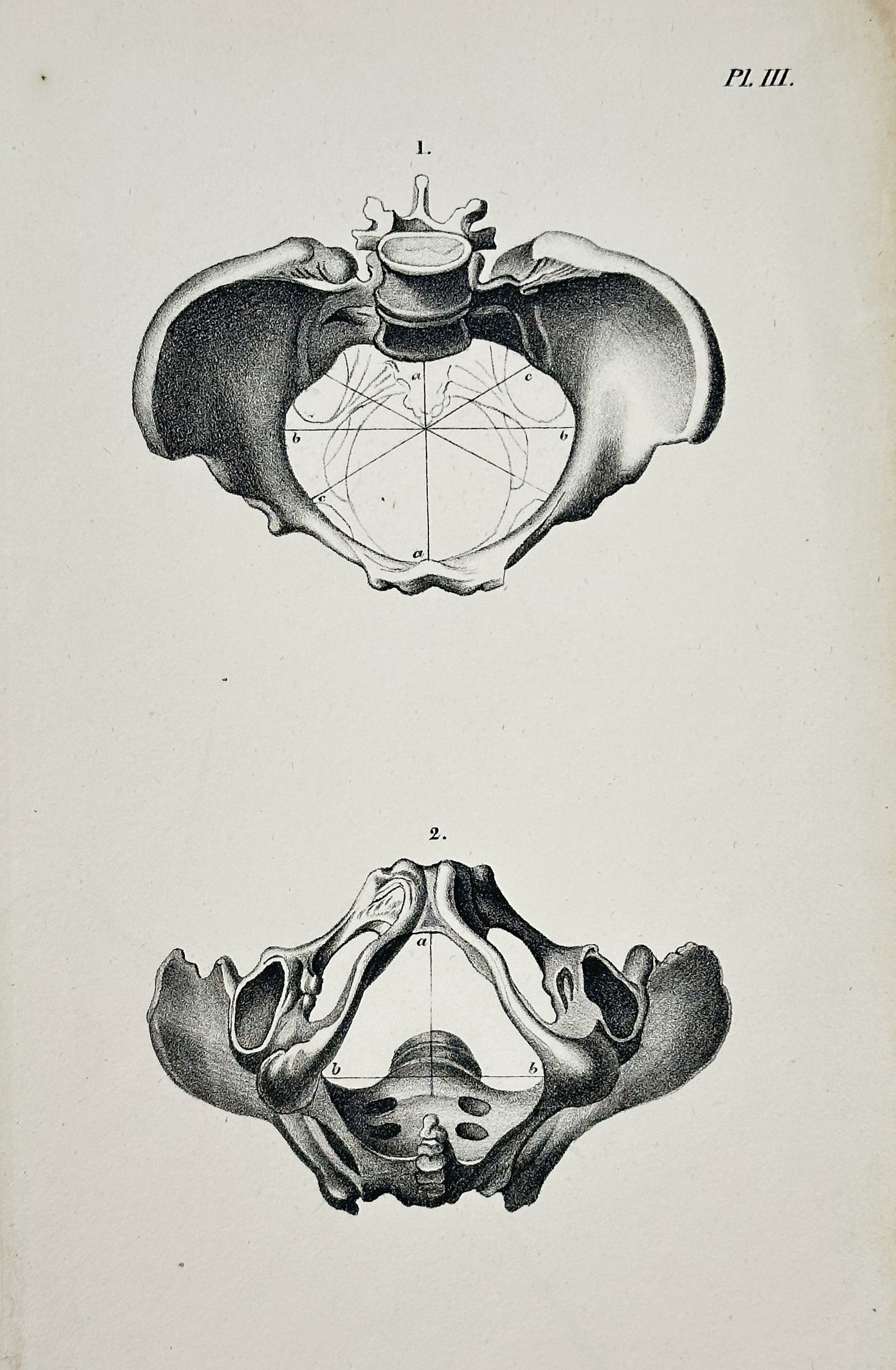 Jacques Pierre – Anatomical Study of the Pelvis in Two Views – Engraving (Early 19th Century) (1 of 2)