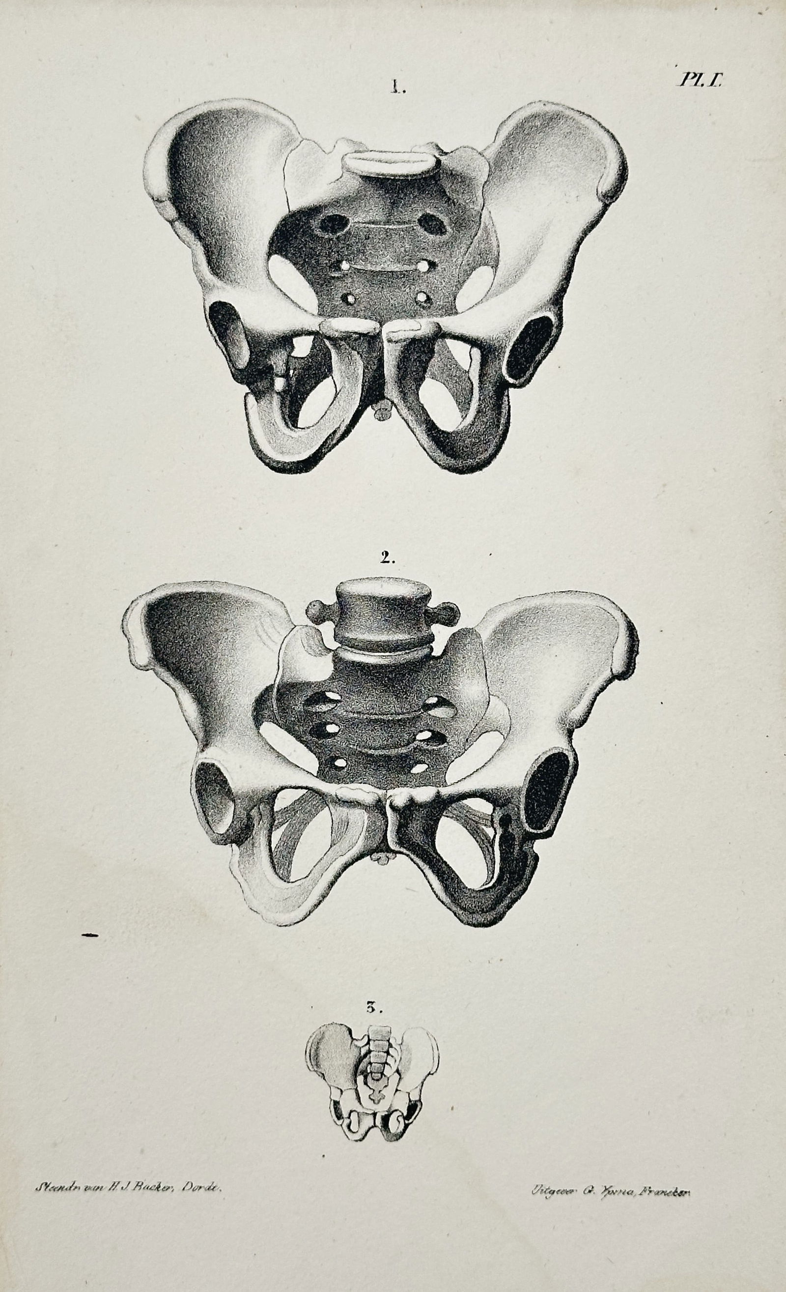 B. Pierre – Comparative Anatomical Study of the Pelvis in Three Views – Engraving (Early 19th (1 of 2)