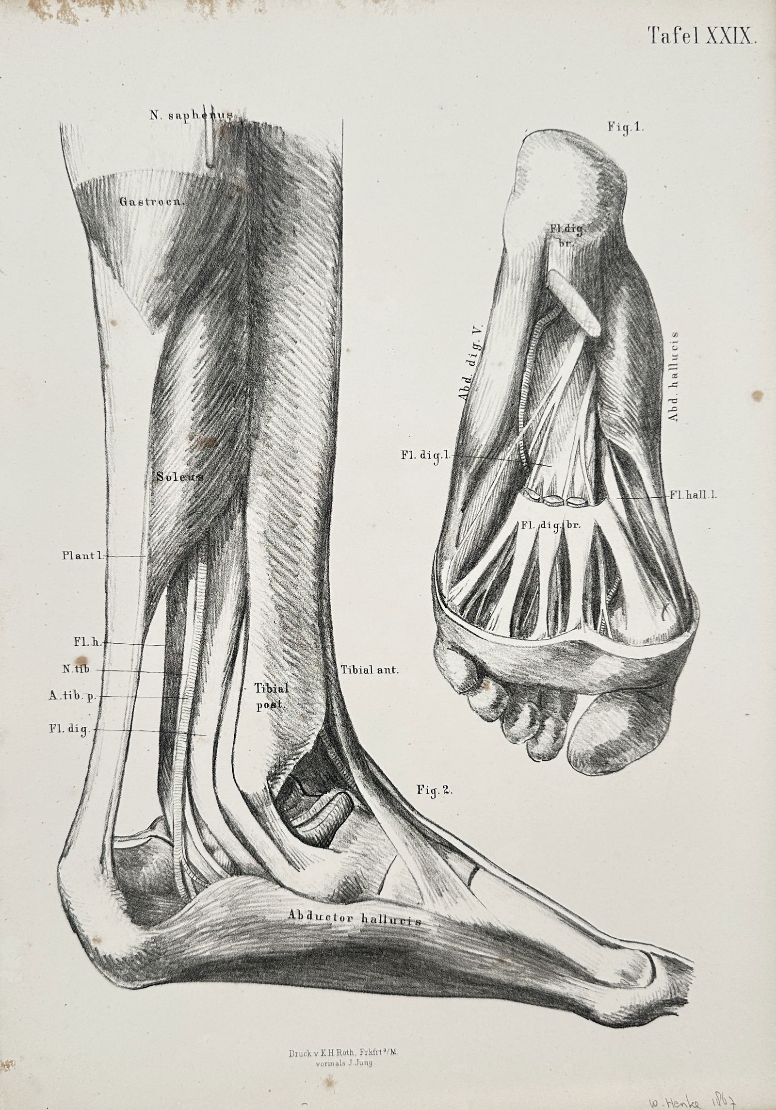 J. Jung – Anatomical Illustration of the Musculature of the Foot and Ankle – Lithograph (1 of 2)