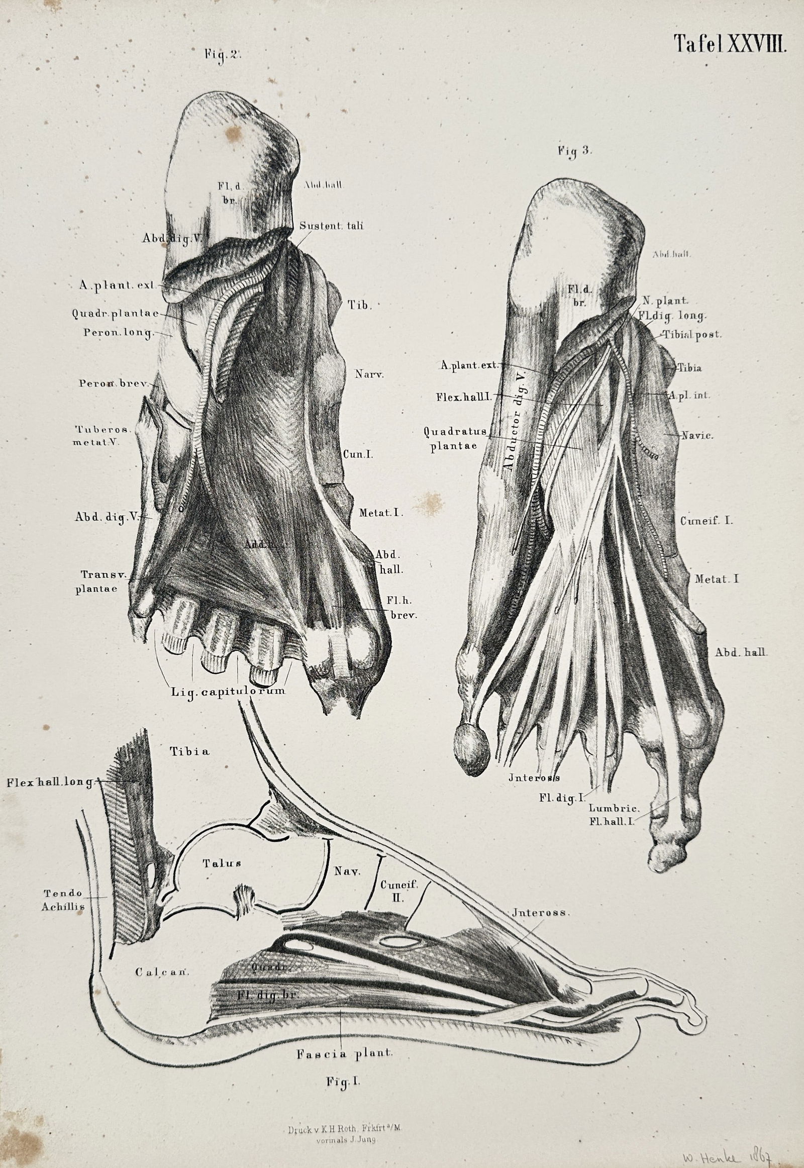 J. Jung – Deep Anatomy of the Foot, including Plantar Fascia and Arches – Lithograph (1 of 2)