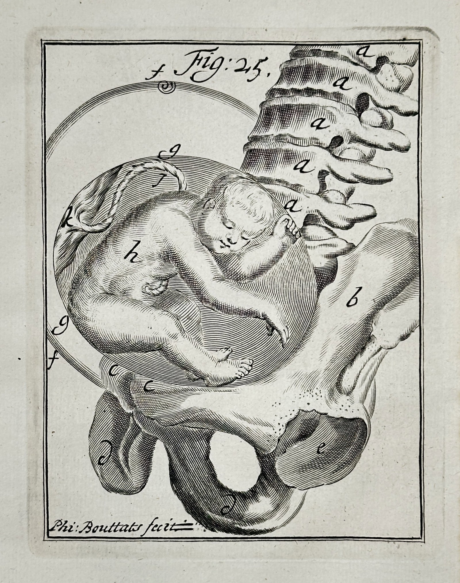 Hendrik van Deventer – Illustration of Fetus in Utero Relative to the Pelvis and Spine – Copper: This medical illustration depicts a fetus curled within the uterus, shown in relation to the female pelvic structure and a section of the spine. The plate originated from a major European anatomical a