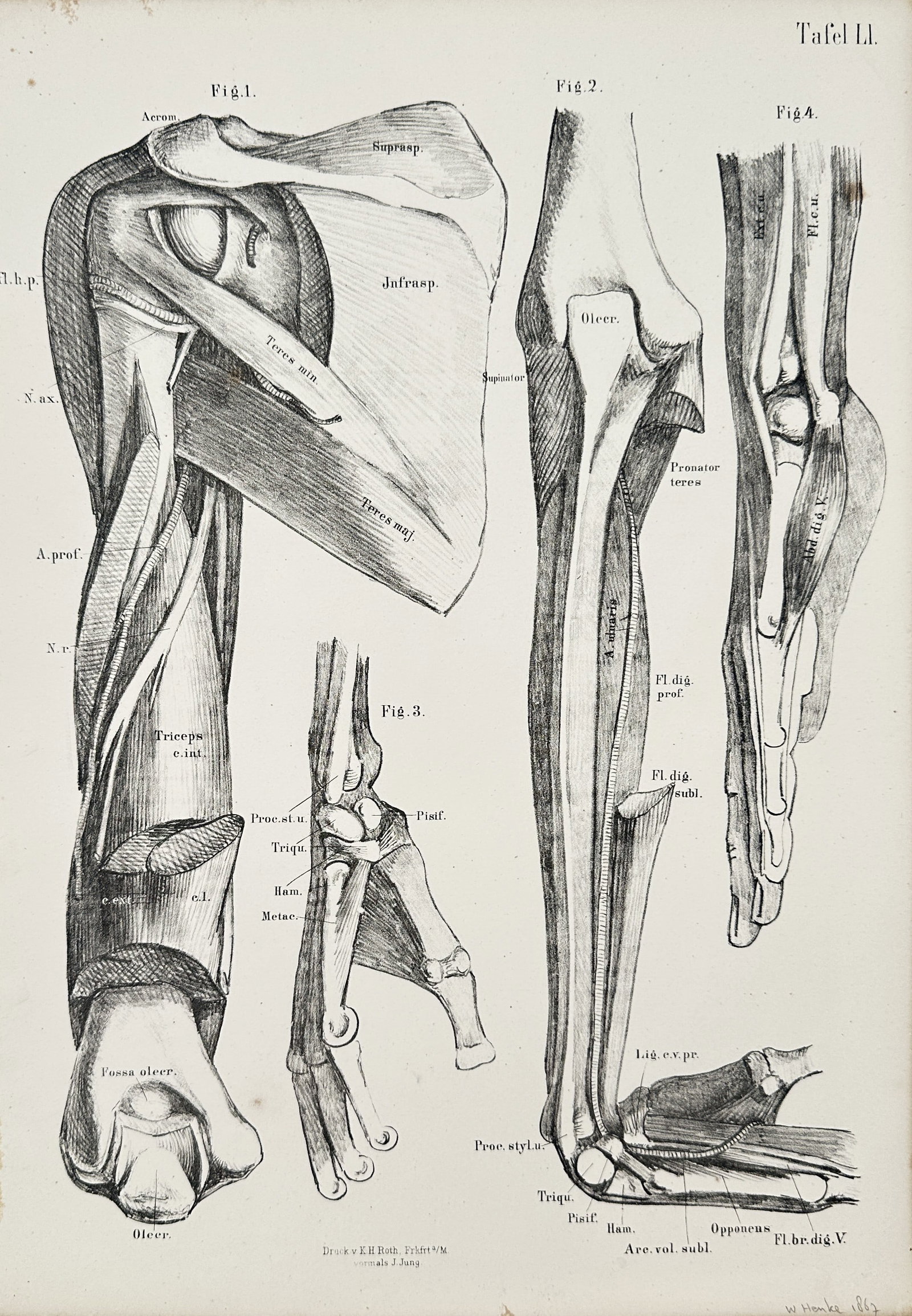 J. Jung – Comparative Anatomy of the Upper Limb: Shoulder, Arm, and Hand – Lithograph: This lithograph presents a comprehensive comparative anatomical study of the human upper limb in four figures. Figure 1 details the complex muscles and joint structures of the shoulder and upper arm, 
