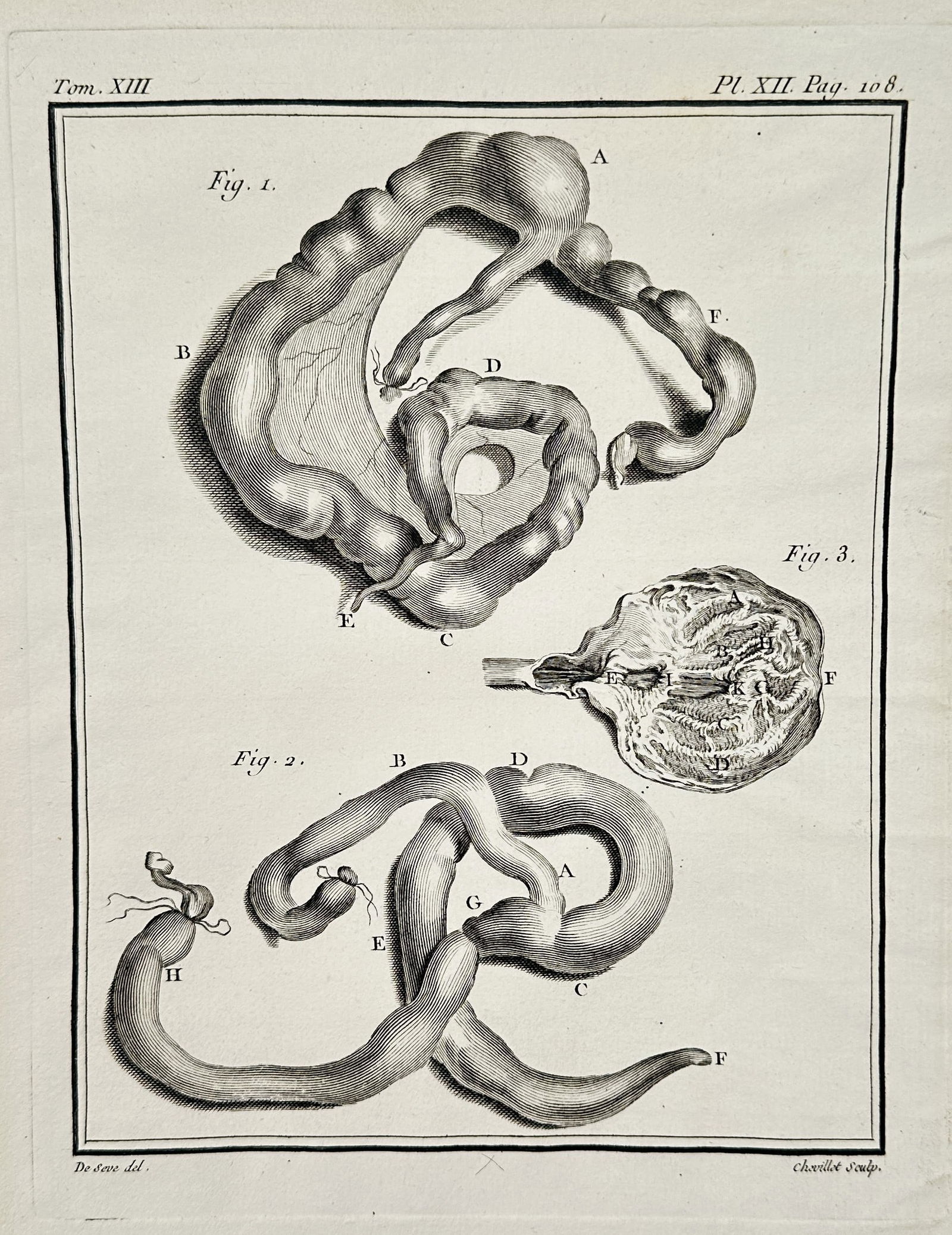 Georges-Louis Leclerc, Comte de Buffon – Comparative Anatomical Study of Coiled: This copperplate engraving provides a detailed comparative anatomical study, featuring illustrations of coiled tubular organs in two figures and a single figure detailing a complex, highly convoluted