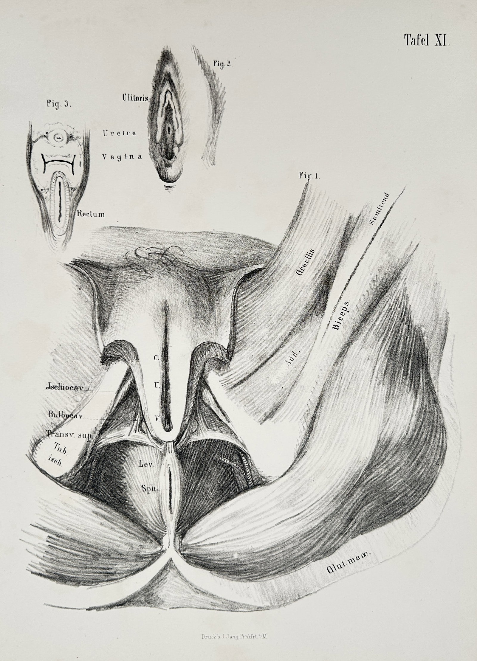 Wilhelm Henke (1834–1896) – Anatomical Study of the Female Perineum – Lithograph: This lithograph provides a detailed anatomical study of the female perineal region and pelvic floor, illustrating the deep musculature, external genitalia, and surrounding structures across three figu