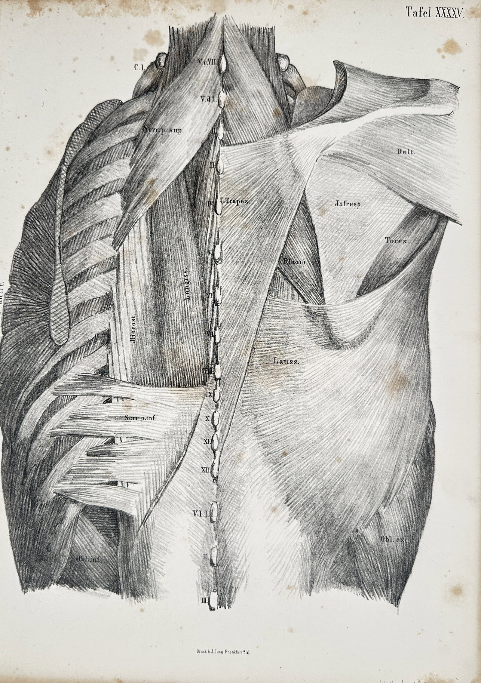 Wilhelm Henke (1834–1896) – Anatomical Study of the Deep Back Muscles – Lithograph (1869) (1 of 2)
