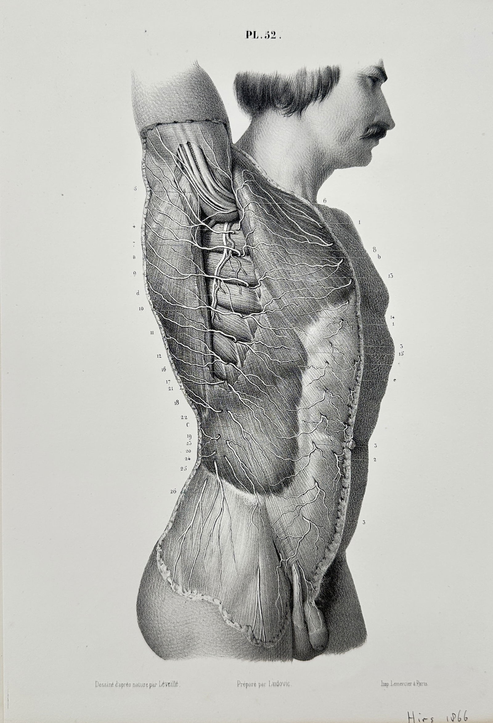 Hirs (19th Century) – Anatomical Study of the Superficial Nerves of the Back – Engraving (1866) (1 of 2)