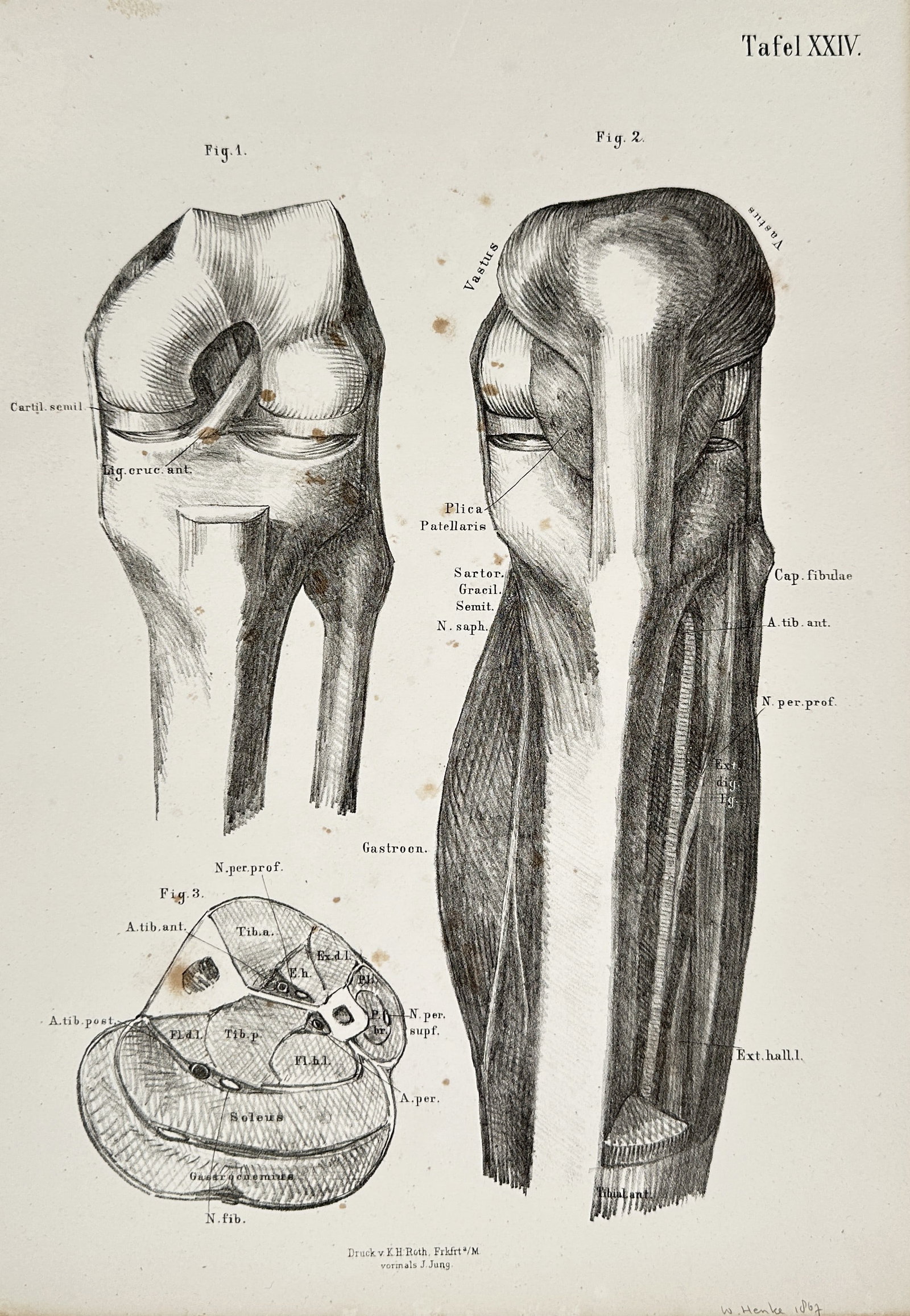 Wilhelm Henke (1834–1904) – Anatomy of the Knee and Lower Leg – Lithograph (1887): This lithograph is a detailed anatomical illustration depicting the structure of the human knee joint and lower leg musculature and nerves, labeled with Latin terms. This plate likely originates from 