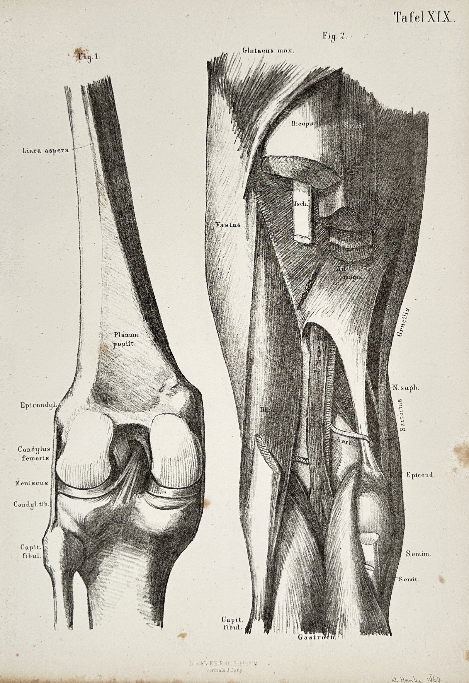 Wilhelm Henke (1834–1904) – Anatomy of the Knee Joint and Musculature – Lithograph (1887): This lithograph is a detailed anatomical illustration depicting the structure of the human knee joint, showing both bone detail and the surrounding muscles of the upper leg, labeled with Latin terms. 