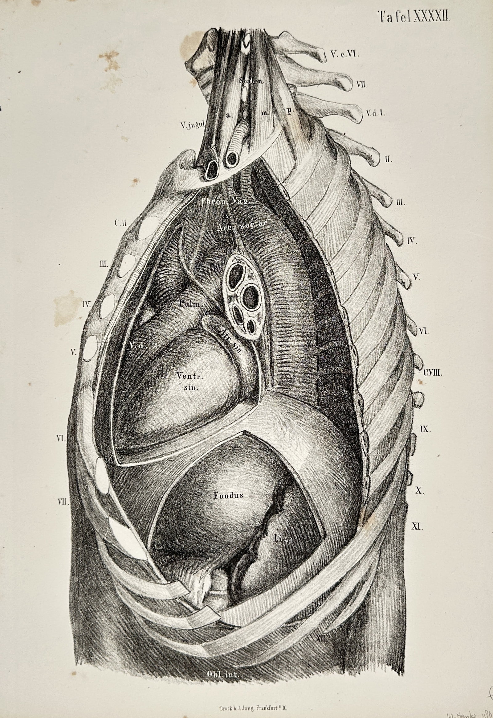 Wilhelm Henke (1834–1904) – Anatomy of the Thorax and Heart – Lithograph (1887): This lithograph is a detailed anatomical illustration depicting the contents of the human thorax, focusing on the heart and major blood vessels within the rib cage, labeled with Latin terms. This plat