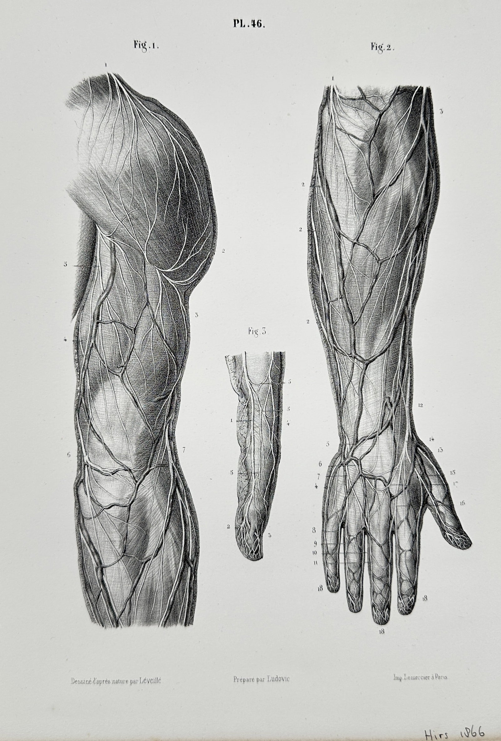 Ludovic Hirschfeld (1814–1896) – Anatomy of the Arm: Nerves and Vessels – Lithograph (1866): This detailed lithograph illustrates the complex network of nerves and vessels in the human arm and hand, showing both the upper arm and forearm. This illustration is from Ludovic Hirschfeld’s celeb