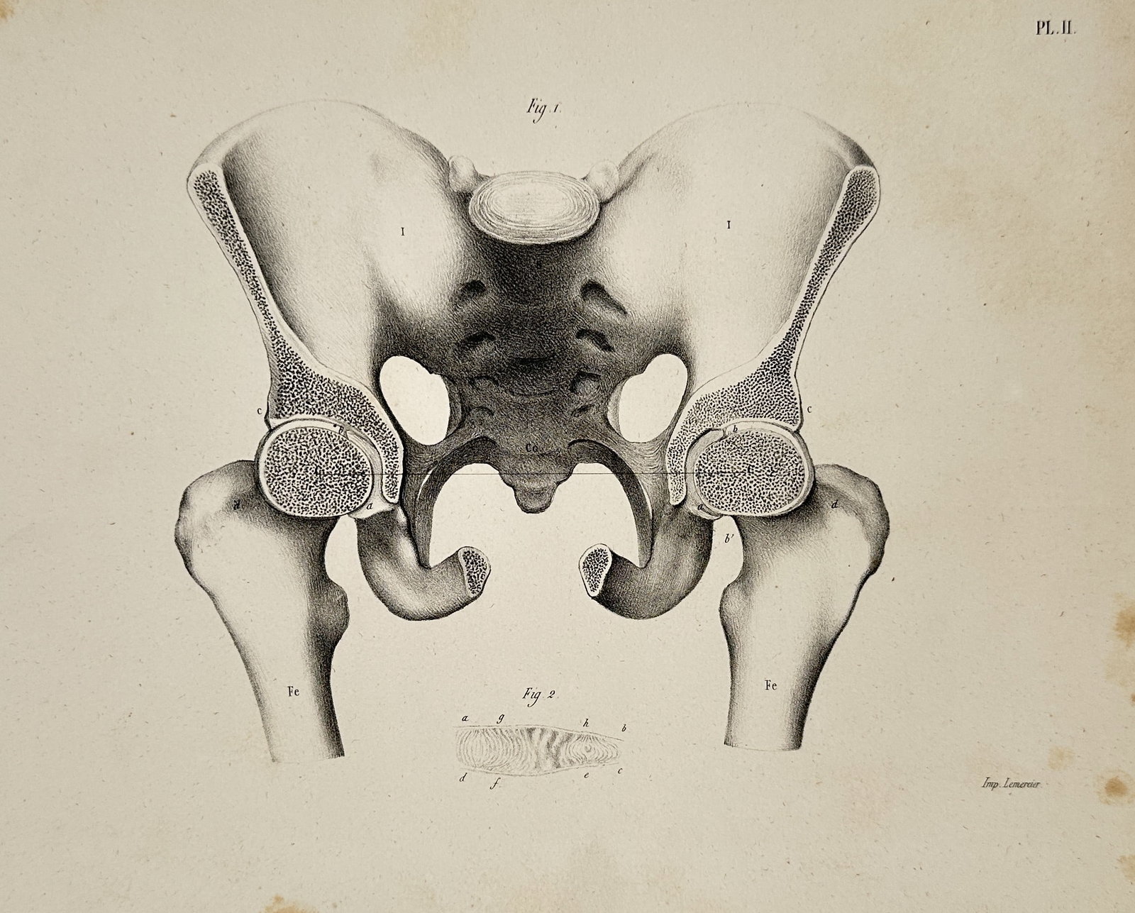 Theodor Ludwig Wilhelm von Bischoff (1807–1882) – Human Pelvis and Hip Joints from the (1 of 2)