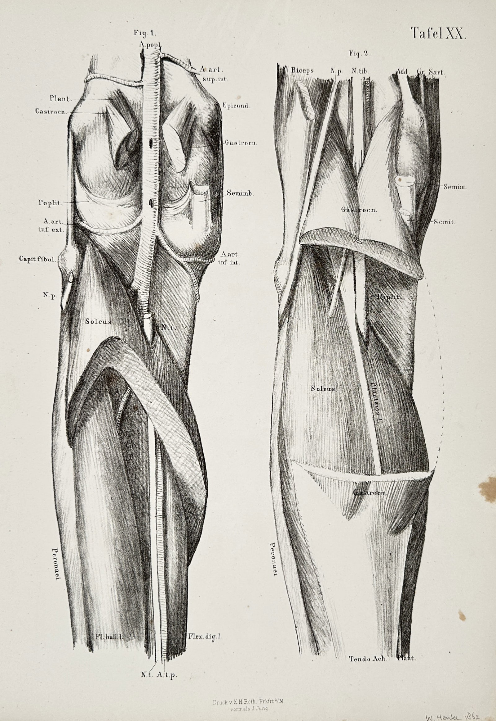 Wilhelm Henke – Anatomical Study of the Human Knee and Lower Leg – Illustration (1867): This illustration depicts a detailed scientific study of the musculature and vasculature of the human lower limb, specifically focusing on the posterior view of the knee and upper calf. The work provi