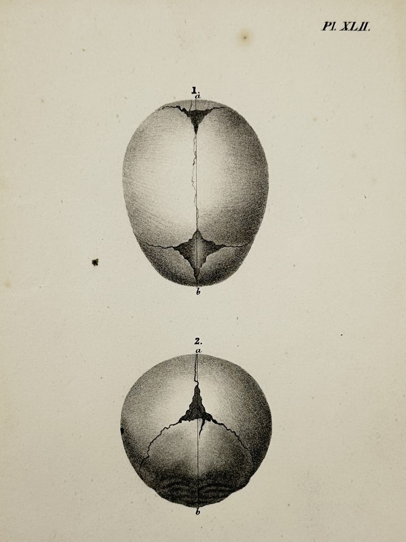 Nicolas Henri Jacob (1782–1871) – Cranial Sutures of a Fetus – Illustration (1831) (1 of 2)