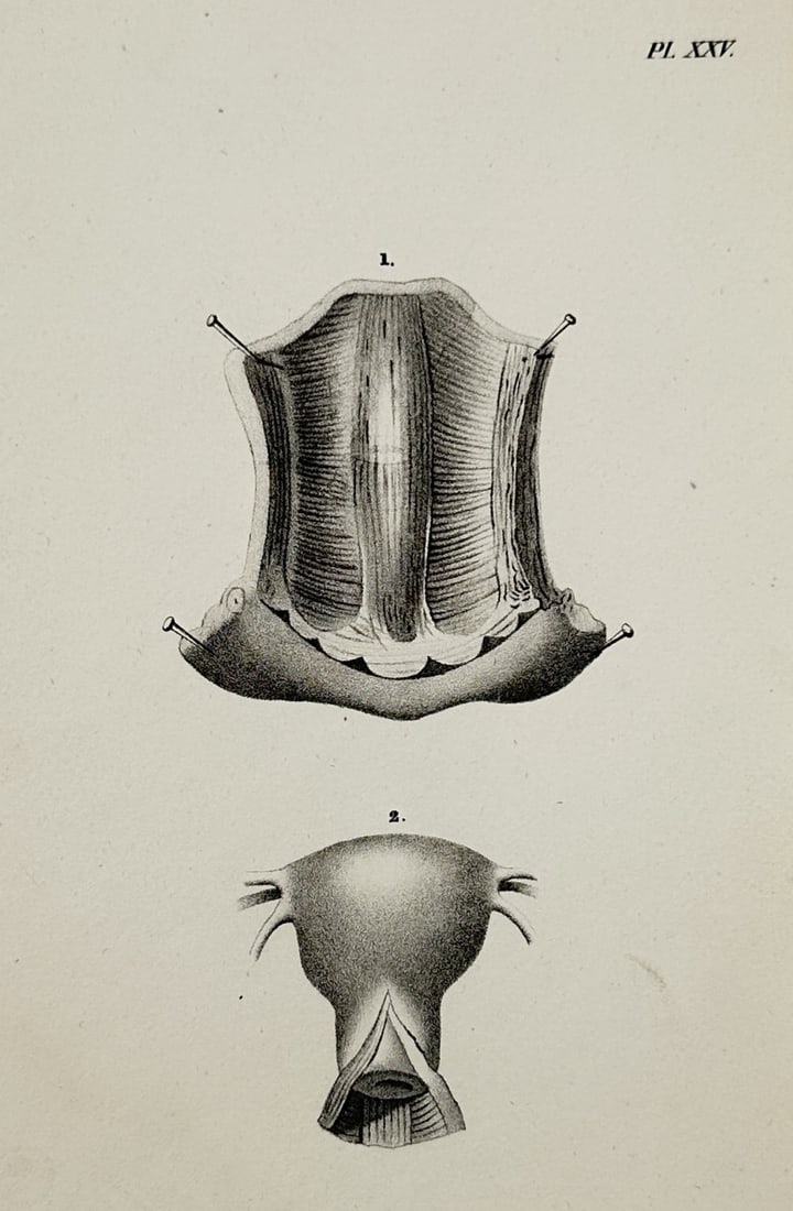 Nicolas Henri Jacob (1782–1871) – Internal Reproductive Organs – Illustration (1831): This anatomical illustration features two detailed views of internal reproductive structures. The upper figure displays a dissected view of the vaginal canal and cervix, pinned open to reveal the inte