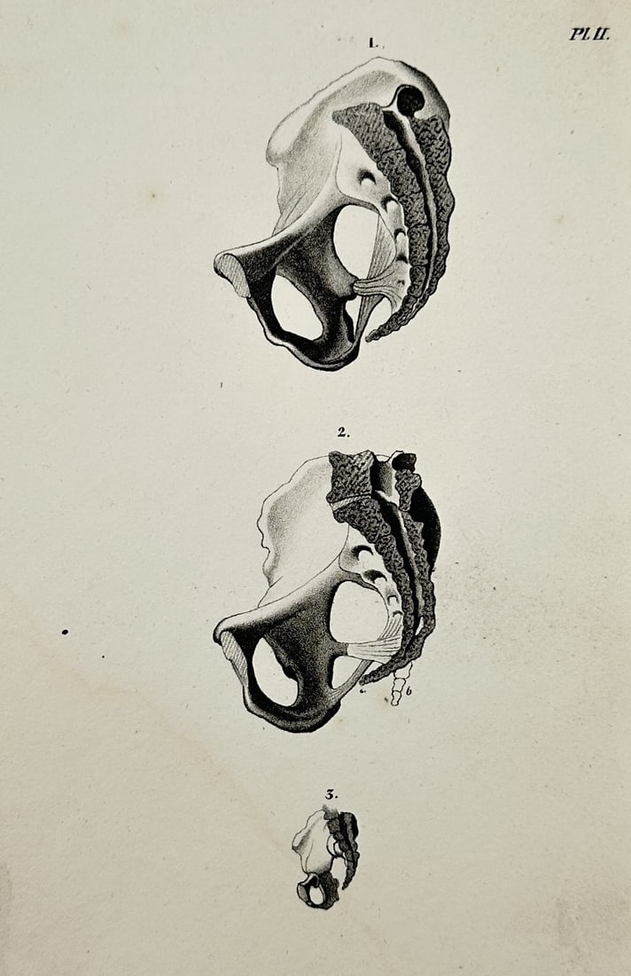 Nicolas Henri Jacob (1782–1871) – Structural Anatomy of the Pelvic Bones – Illustration (1831): This anatomical illustration presents three comparative views of the human pelvic bones, focusing on the ossification and structural development of the os coxae. The top and middle figures provide lat