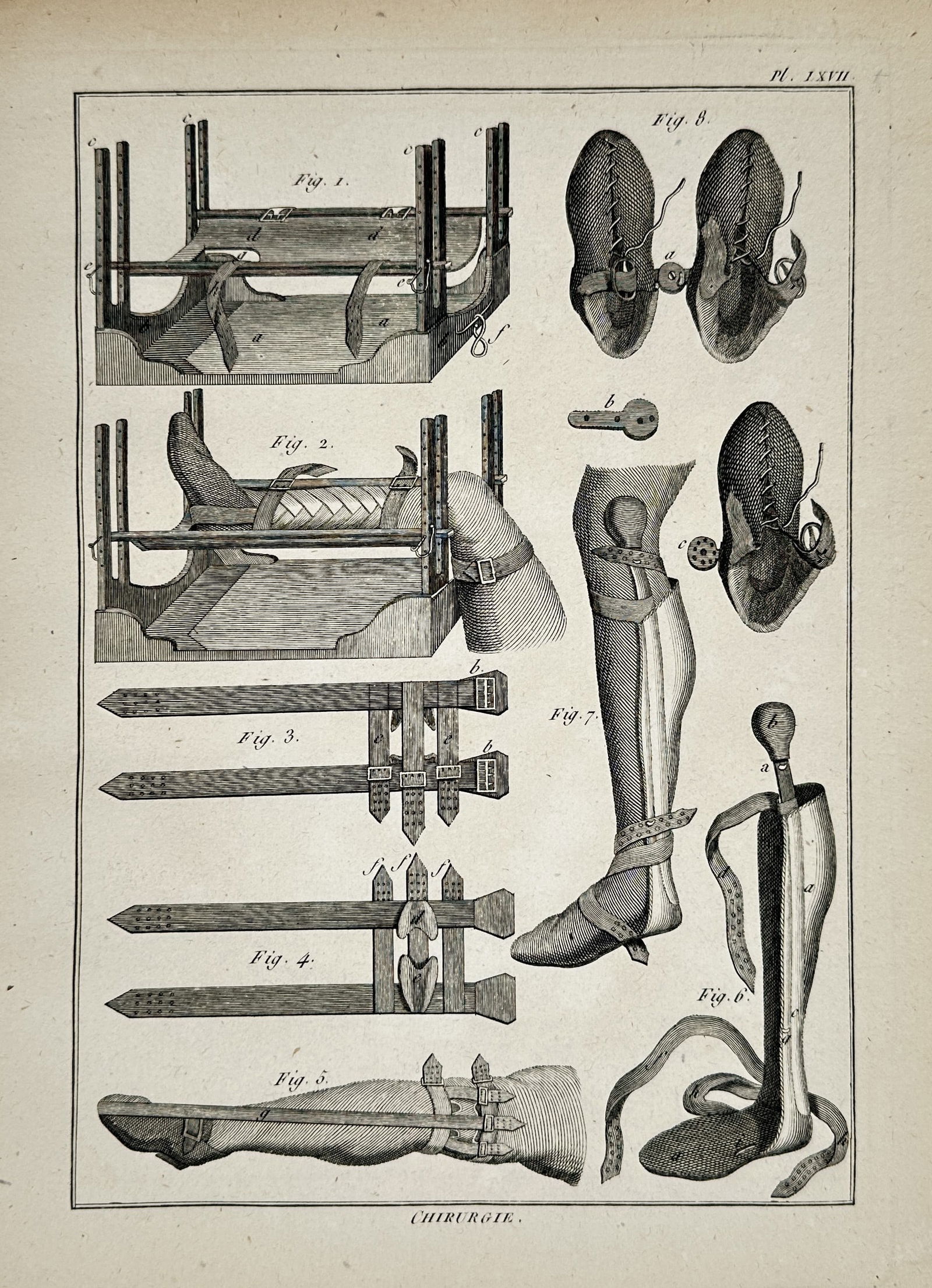 Robert Bénard (1734–c. 1785) – Orthopedic Surgical Instruments and Leg Braces – Engraving (1 of 2)