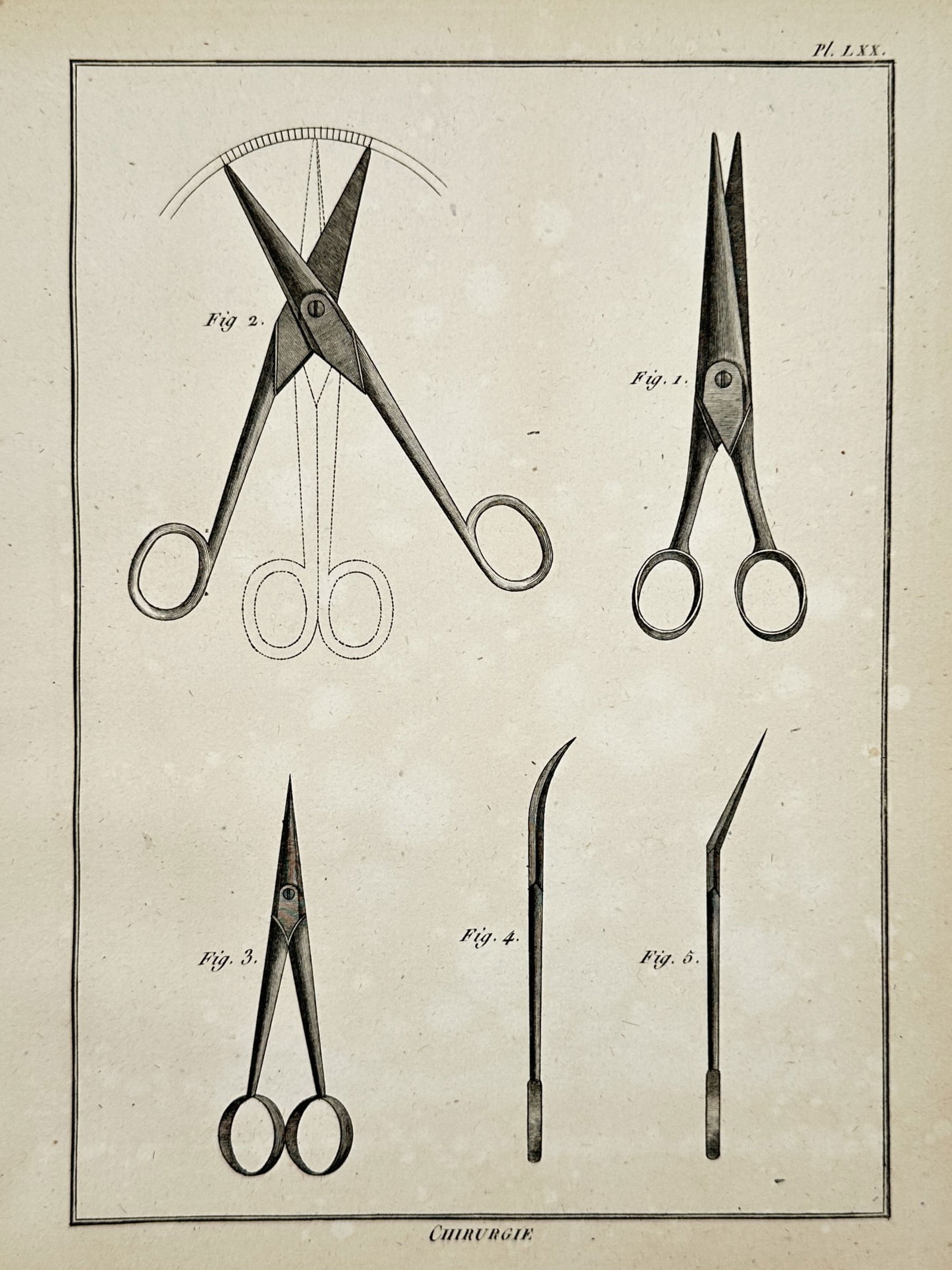 Denis Diderot (1713–1784) – Surgical Scissors – Engraving (18th Century) (1 of 2)