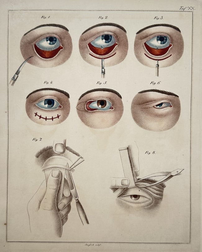 Hermann Eduard Fritze (1811–1866) & Georg Friedrich Otto Reich – Surgical (1 of 2)