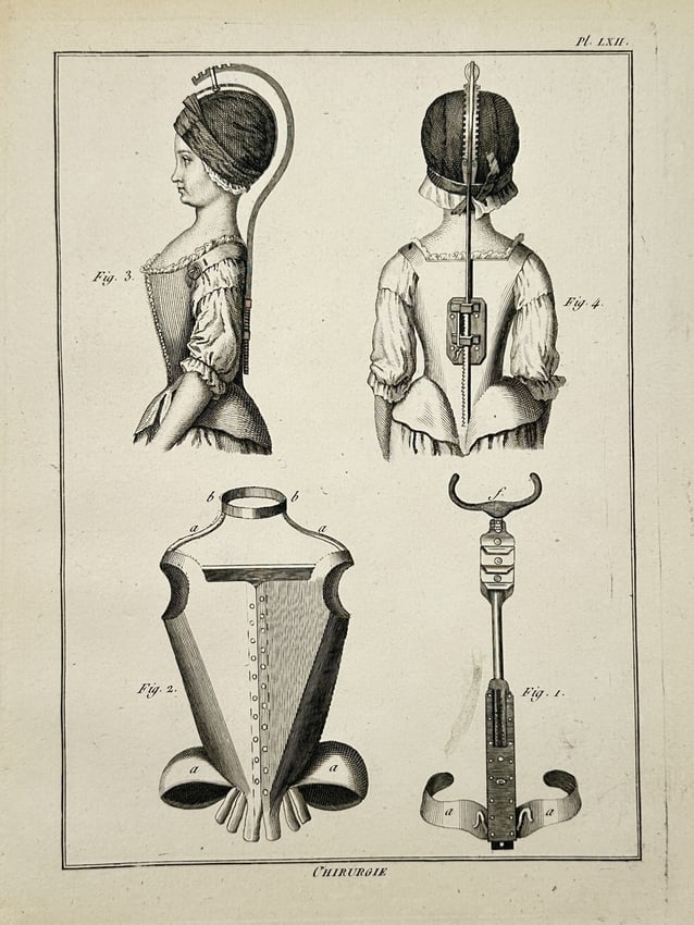 Robert Bénard (1734–1777) – Technical Illustration of Orthopaedic Braces and Bodices: "Chirurgie." This engraving illustrates advanced eighteenth-century medical devices designed for the correction of spinal and postural deformities. The upper register features two portraits of a femal