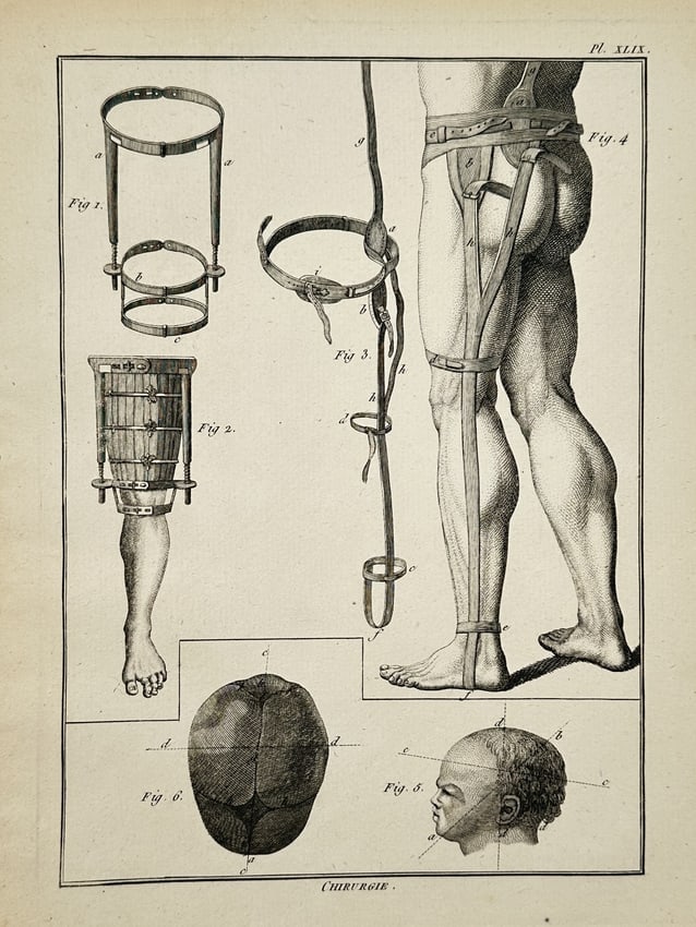 Robert Bénard (1734–1777) – Technical Illustration of Orthopaedic and Surgical Bandages (1 of 2)