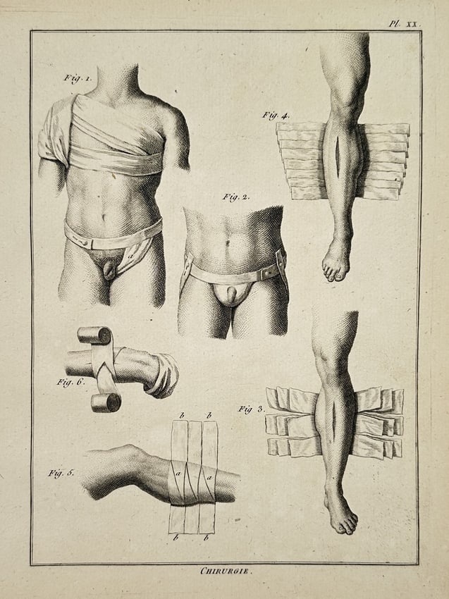 Robert Bénard (1734–1777) – Medical Illustration of Surgical Bandaging Techniques: "Chirurgie." This engraving presents a detailed anatomical and technical study of various surgical bandaging methods used in eighteenth-century medicine. The plate illustrates specialized wraps for th