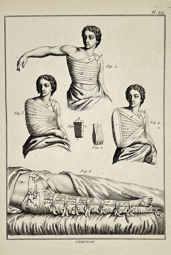 Robert Bénard (1734–1777) – Technical Study of Surgical Bandages for Limbs and Torso: "Chirurgie" depicts various methods for applying medical bandages to the human body to stabilize injuries or support surgical recovery. The composition features four studies of female figures demonstr