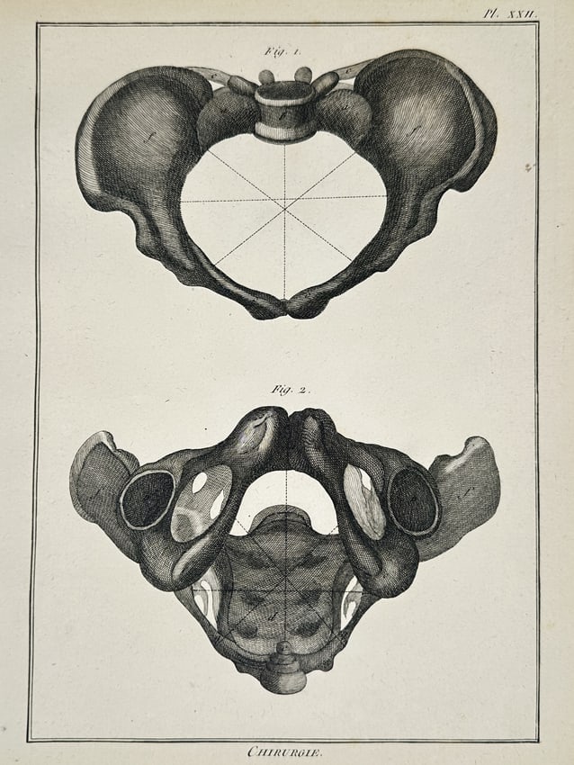 Robert Benard (1734-1785) – Anatomical Study of the Pelvis – Engraving (1771): "Chirurgie" This engraving presents a detailed anatomical study of the human pelvis, specifically focused on obstetric measurements. The upper figure displays a superior view of the pelvic inlet with
