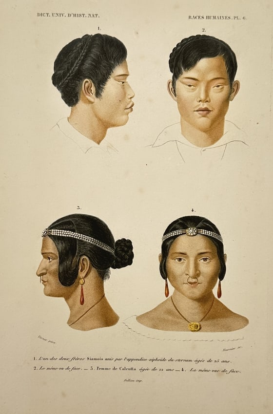 Charles d'Orbigny (1806–1876) – Human Races: Siamese Twins and Calcutta's Woman (1 of 2)